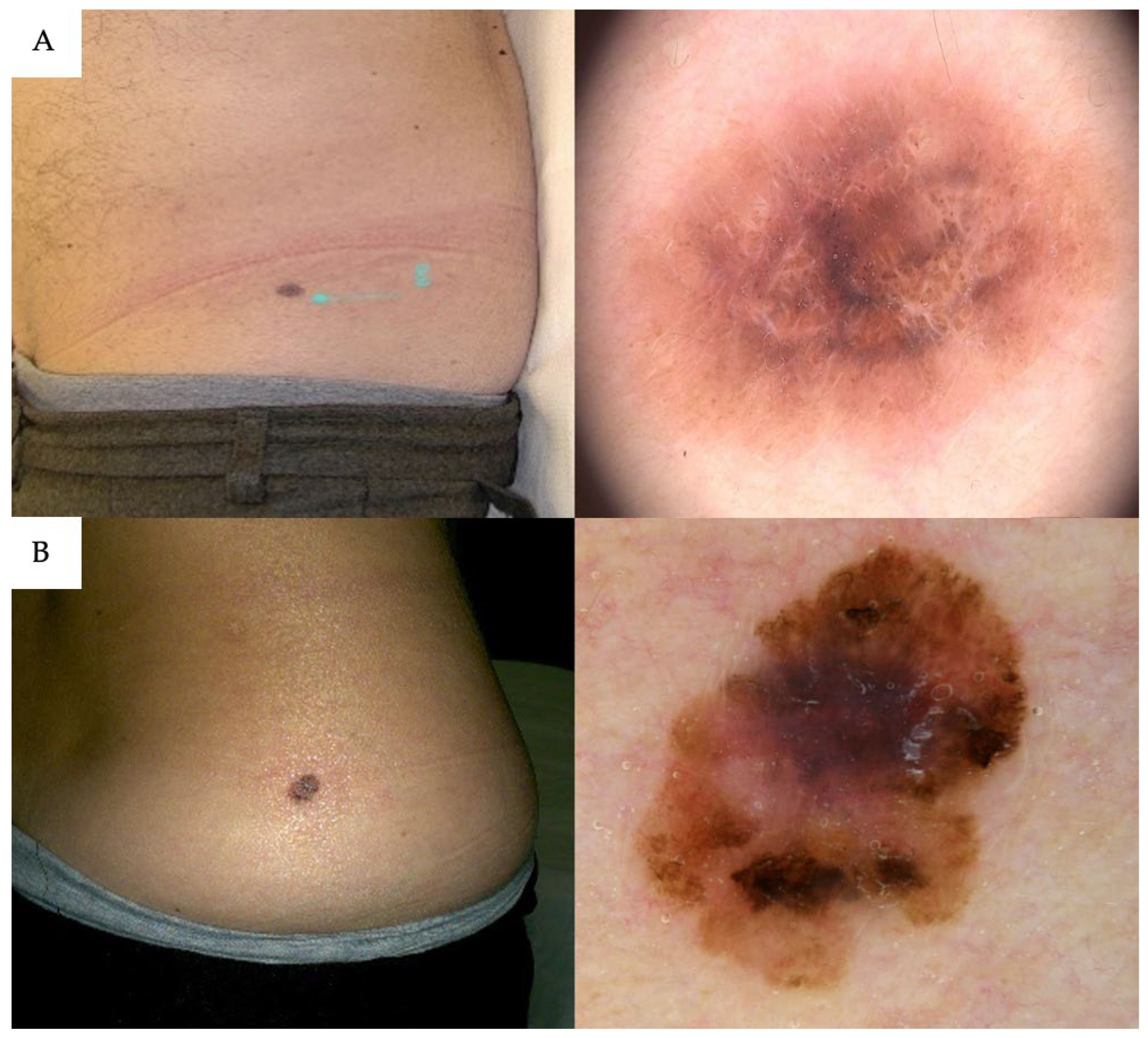 Cancers 17 03064 g002 Cancers 17 03064 g002