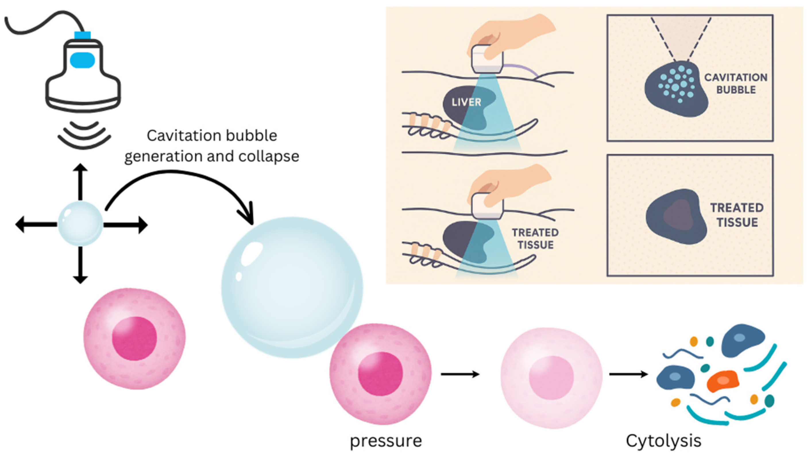 Cancers 17 03072 g001 Cancers 17 03072 g001