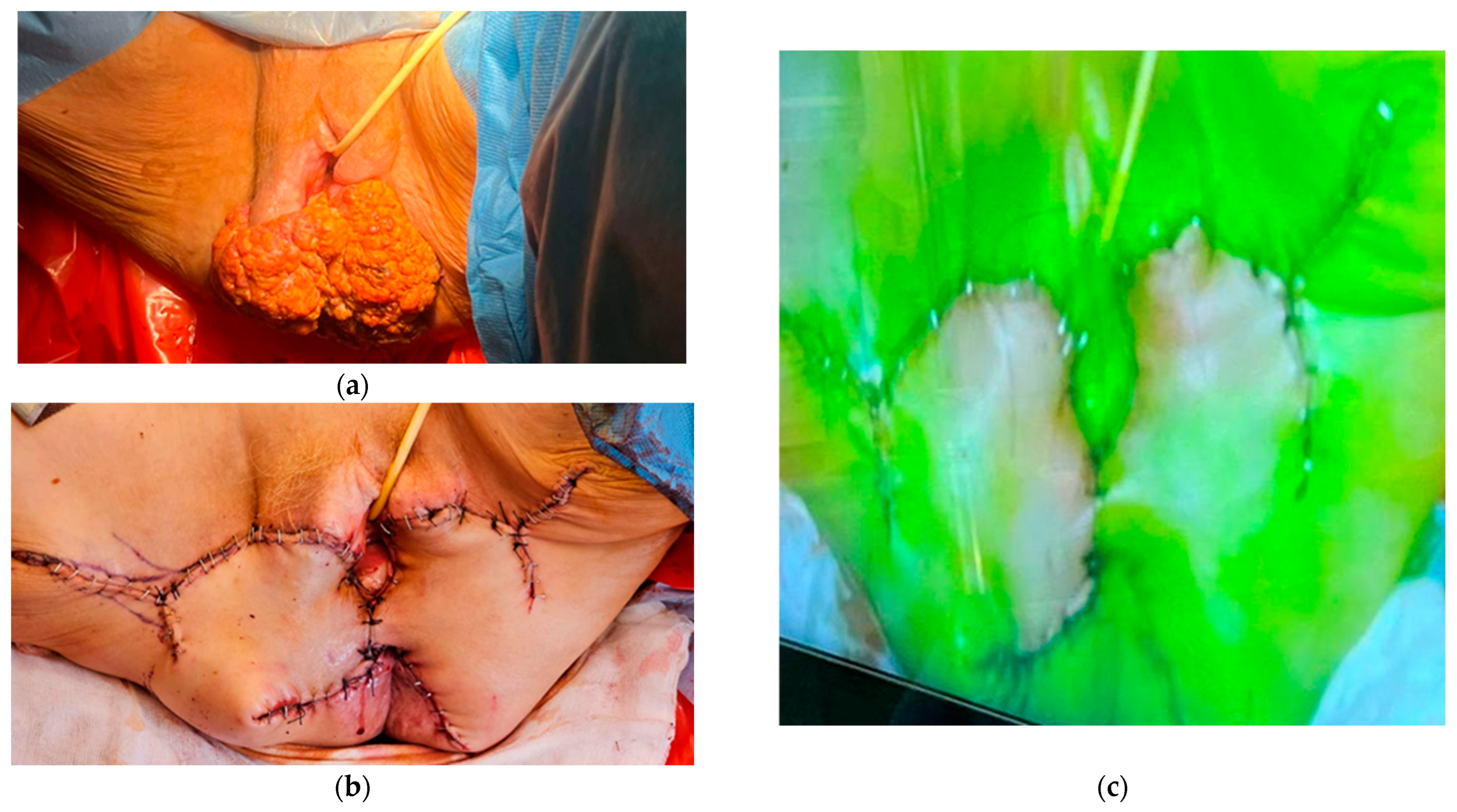 Cancers 17 03081 g002 Cancers 17 03081 g002