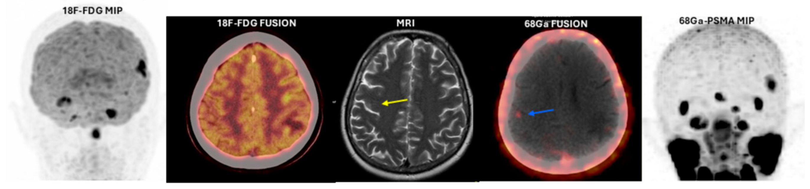Cancers 17 03088 g001