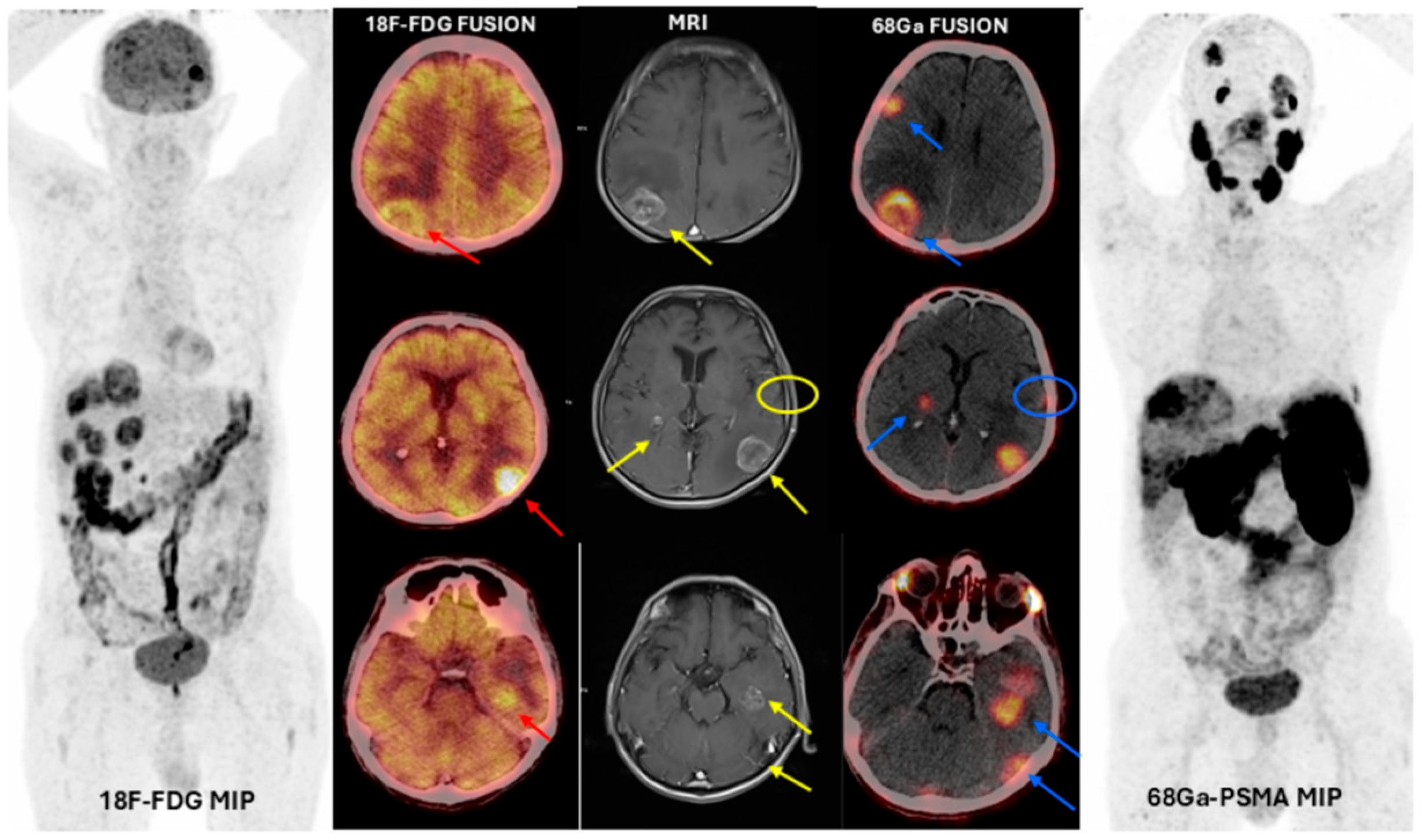 Cancers 17 03088 g002