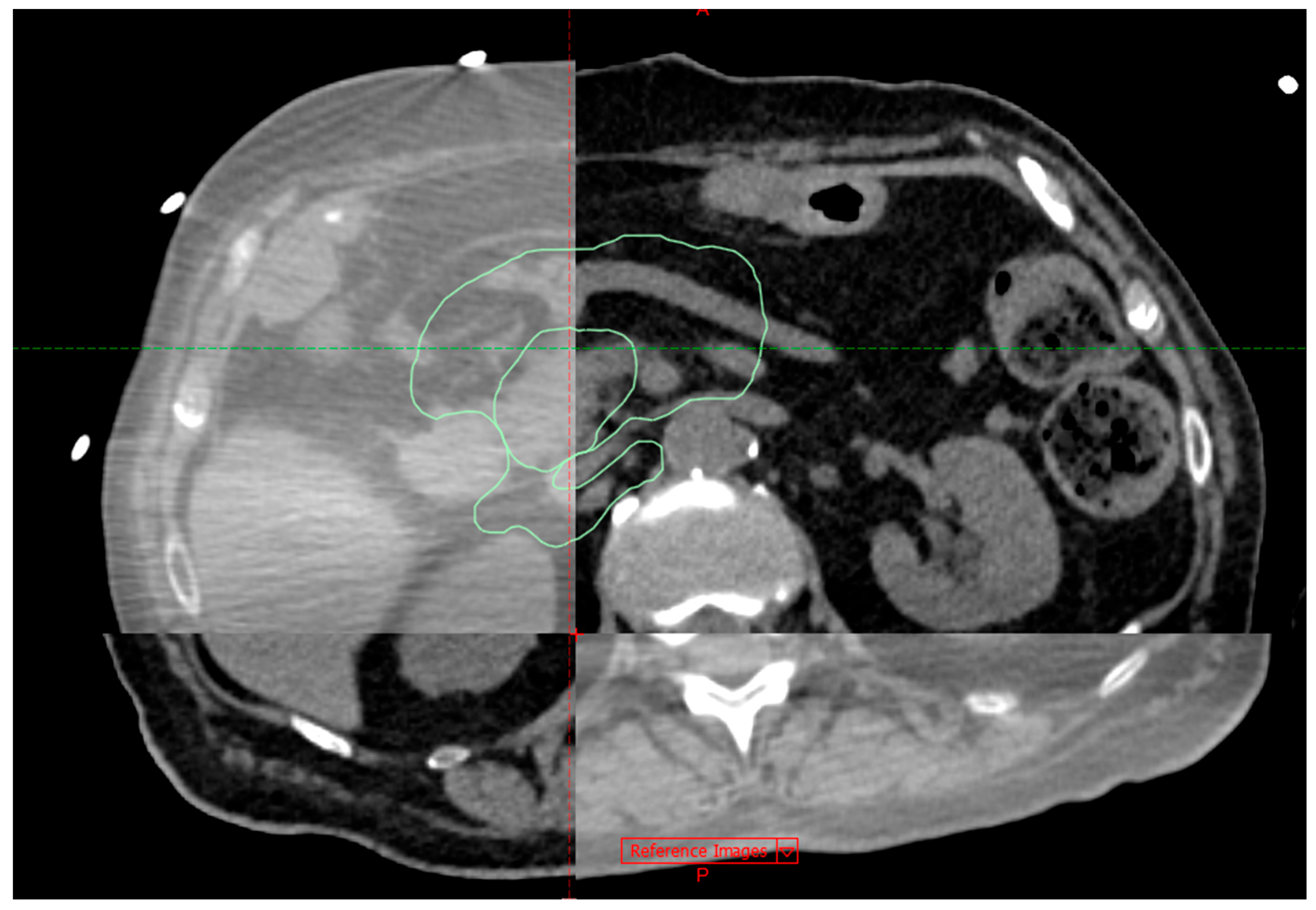 Cancers 17 03093 g003 Cancers 17 03093 g003