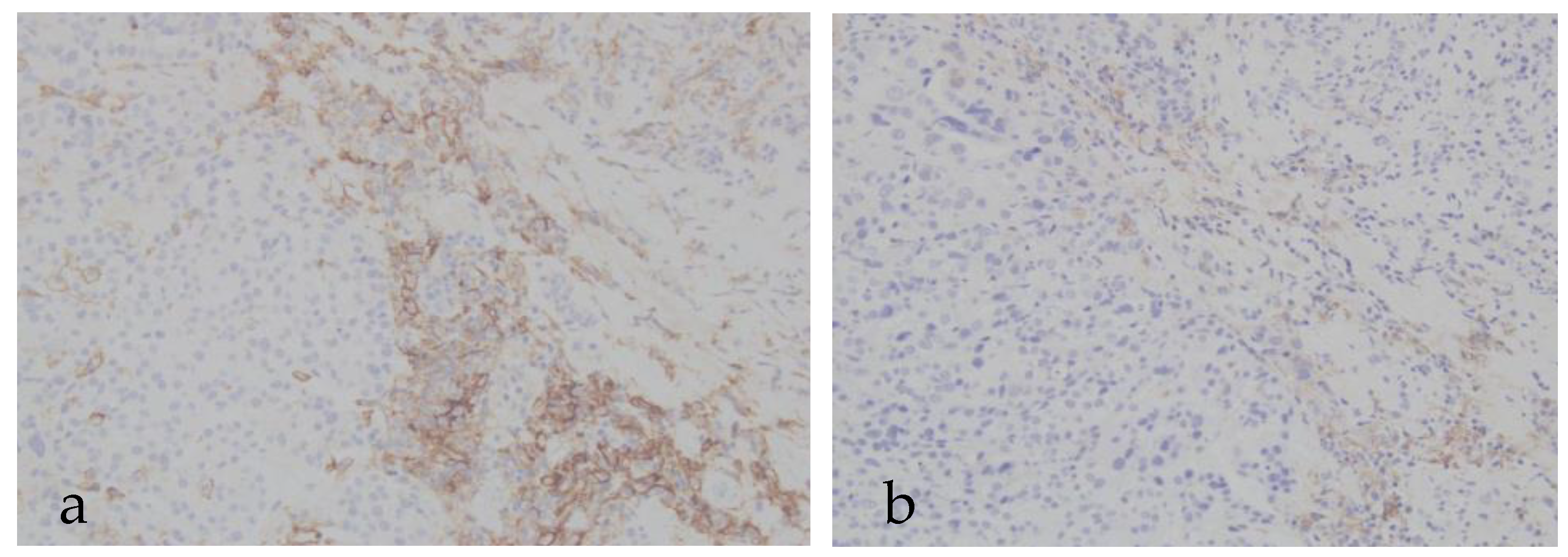 Cancers 17 03103 g001