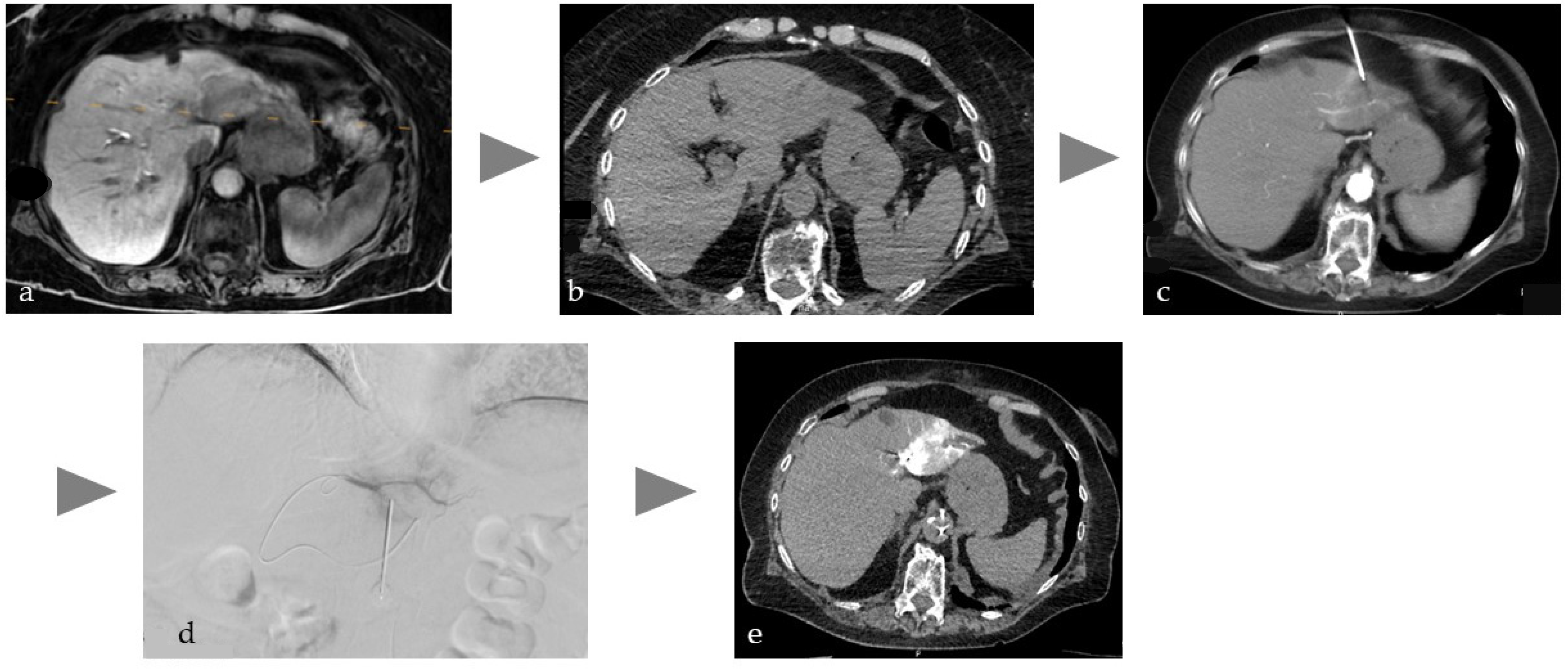 Cancers 17 03116 g001