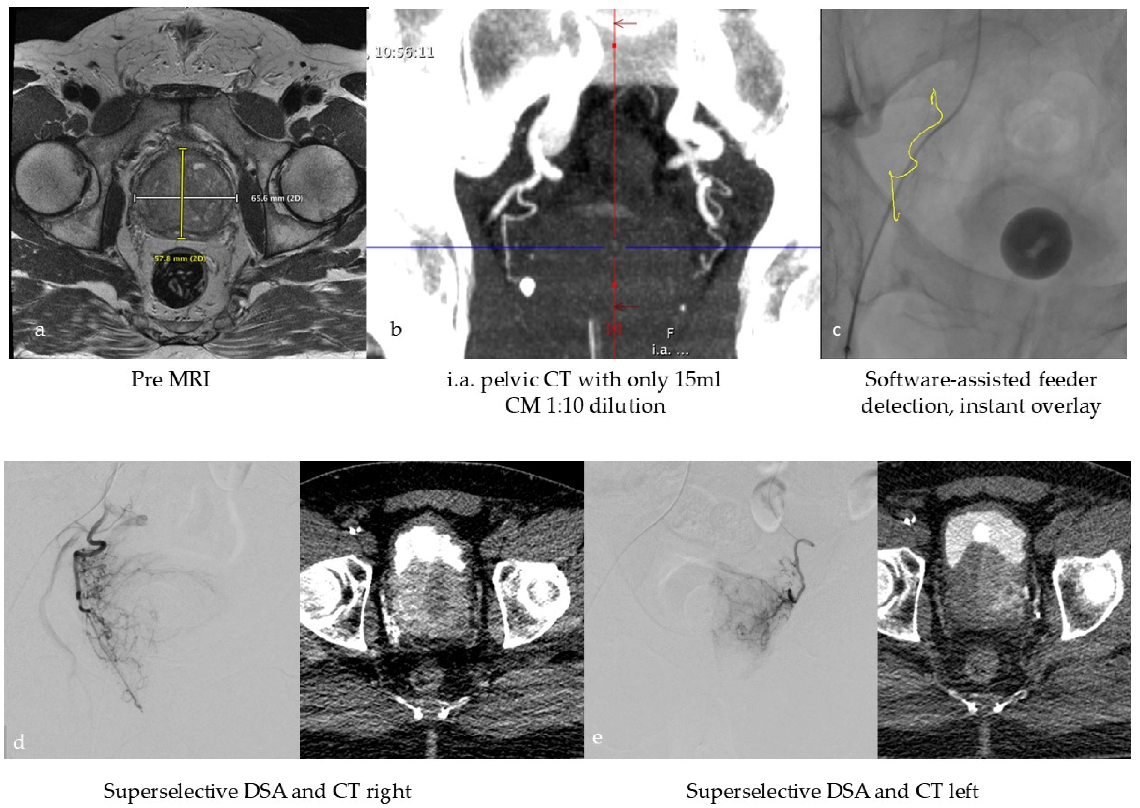 Cancers 17 03116 g002