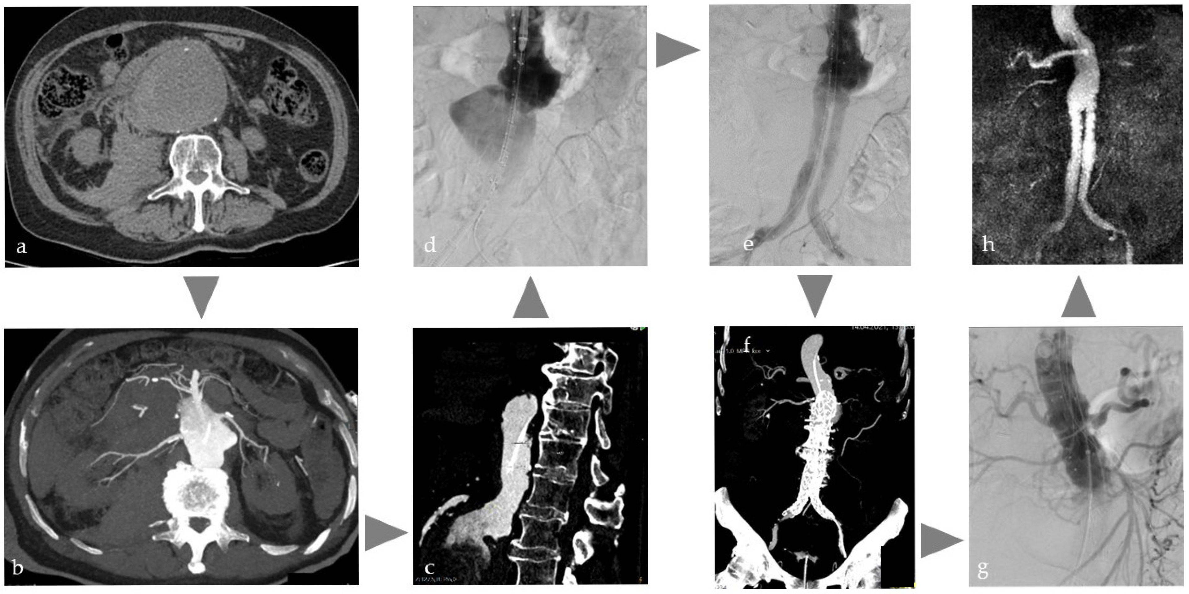 Cancers 17 03116 g004