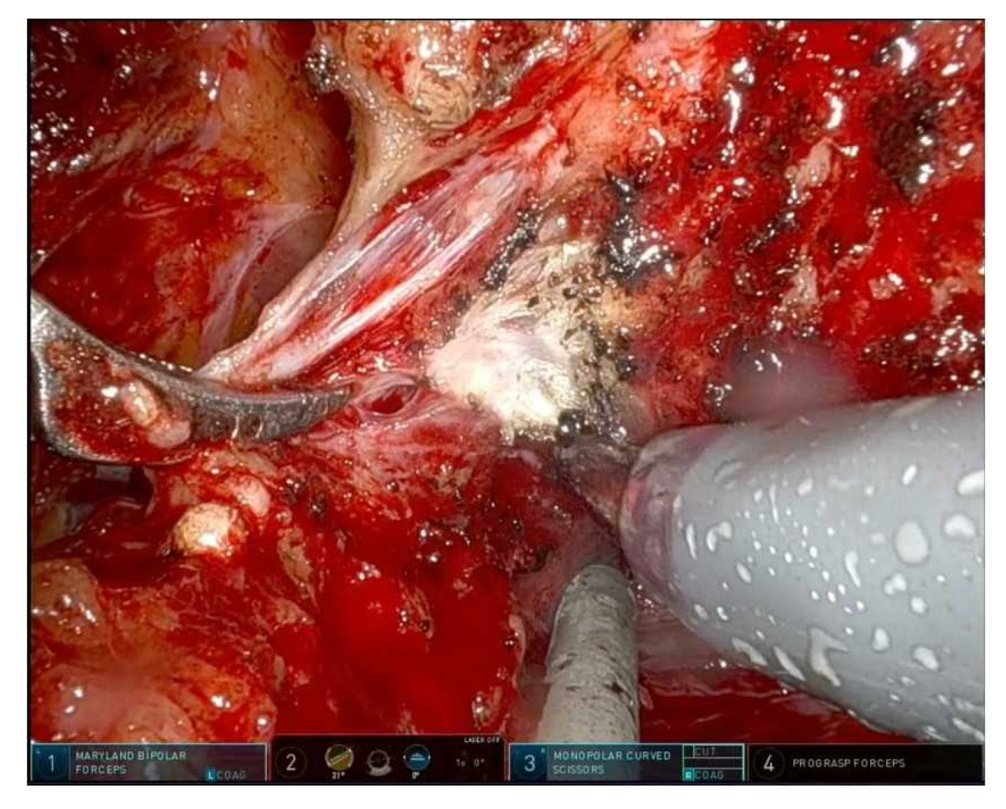 Cancers 17 03122 g003