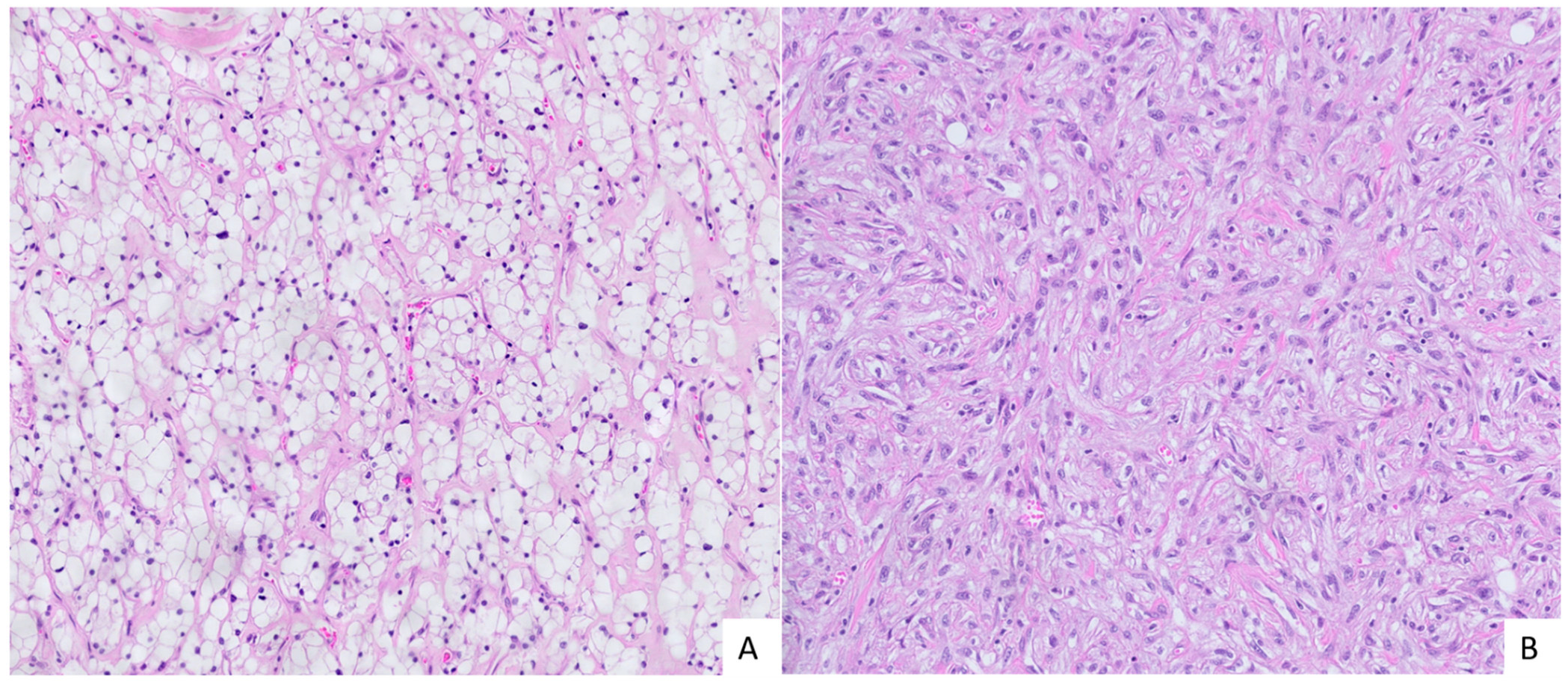 Cancers 17 03123 g001