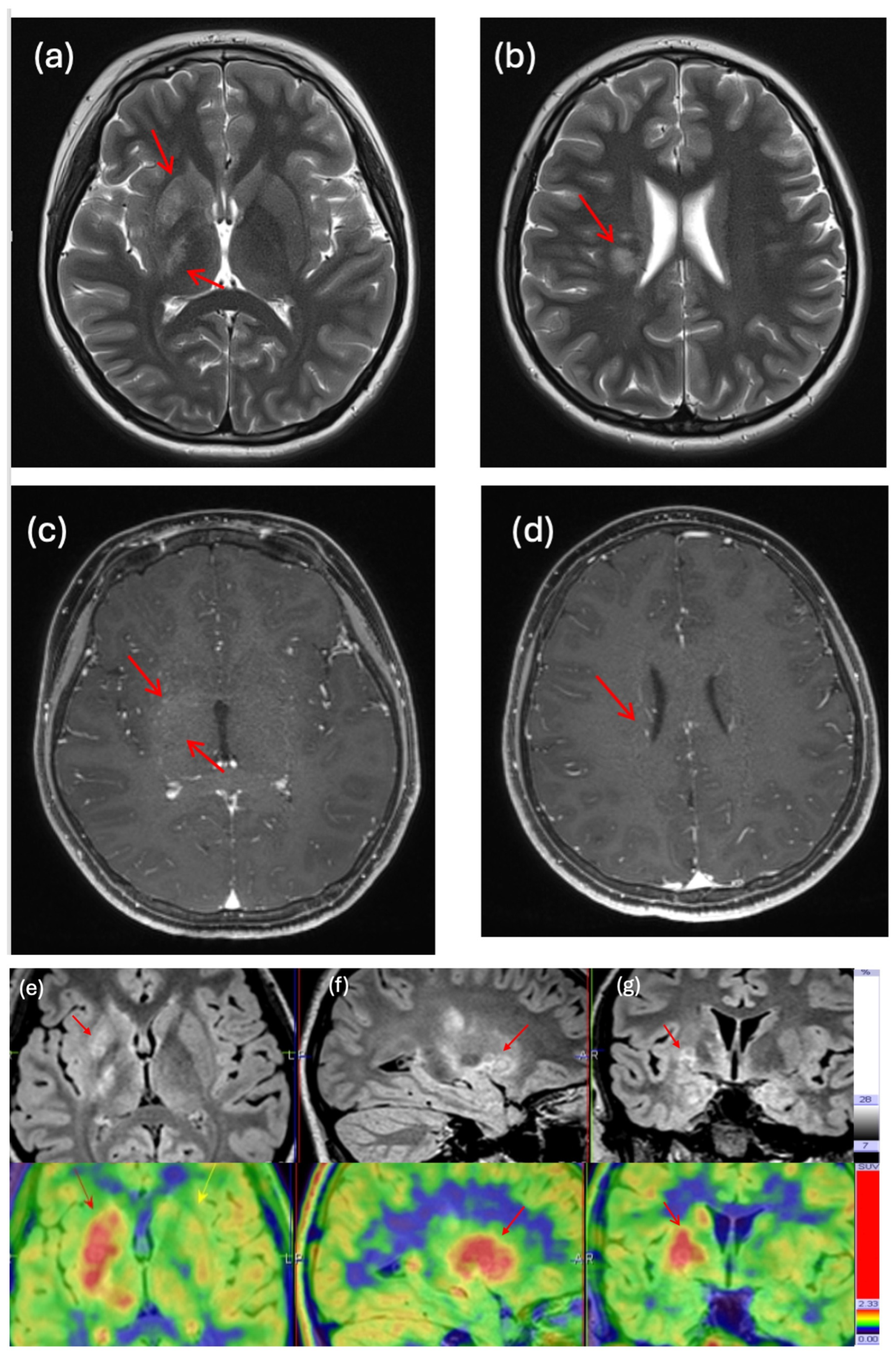 Cancers 17 03233 g004