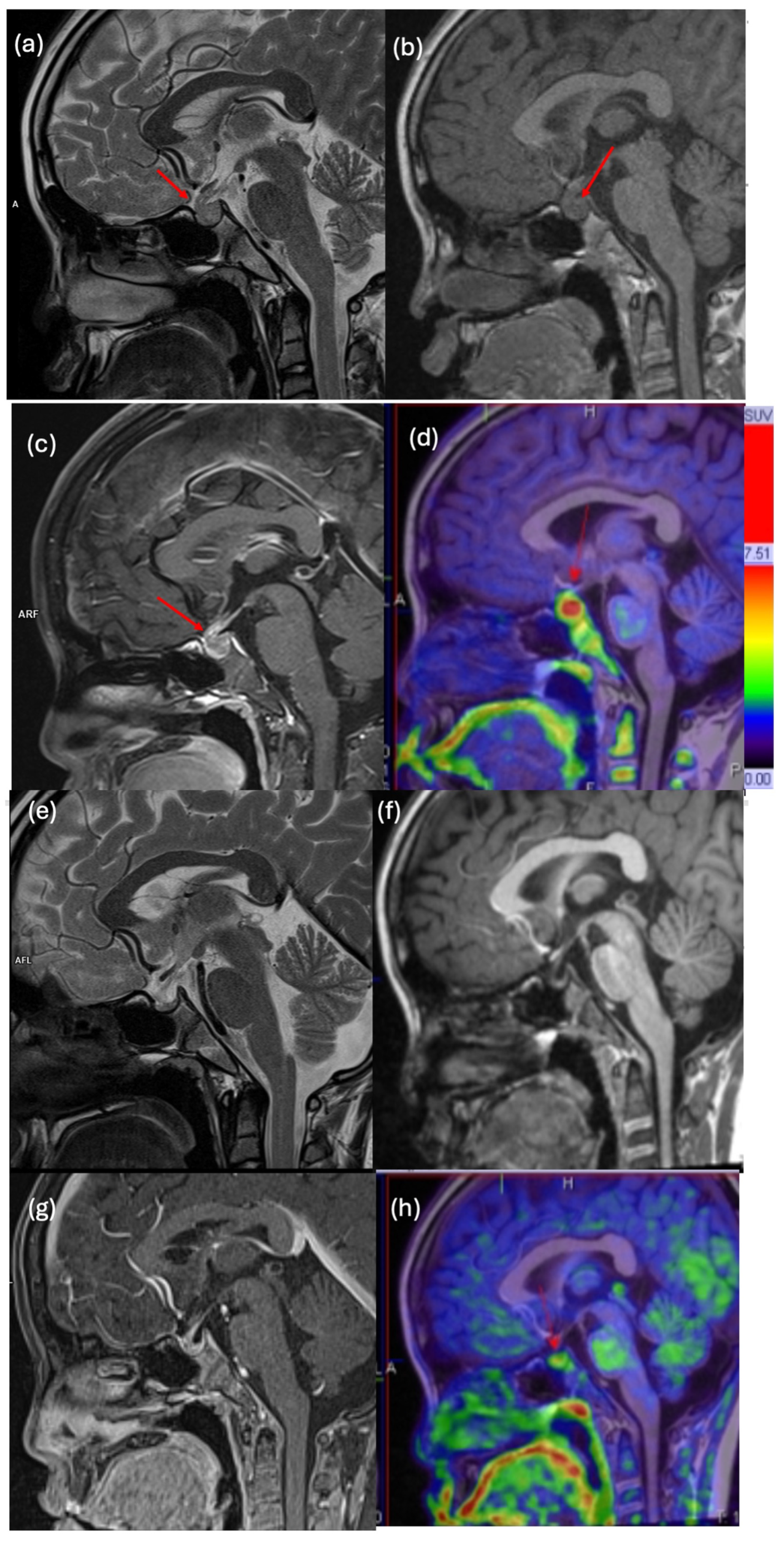 Cancers 17 03233 g005