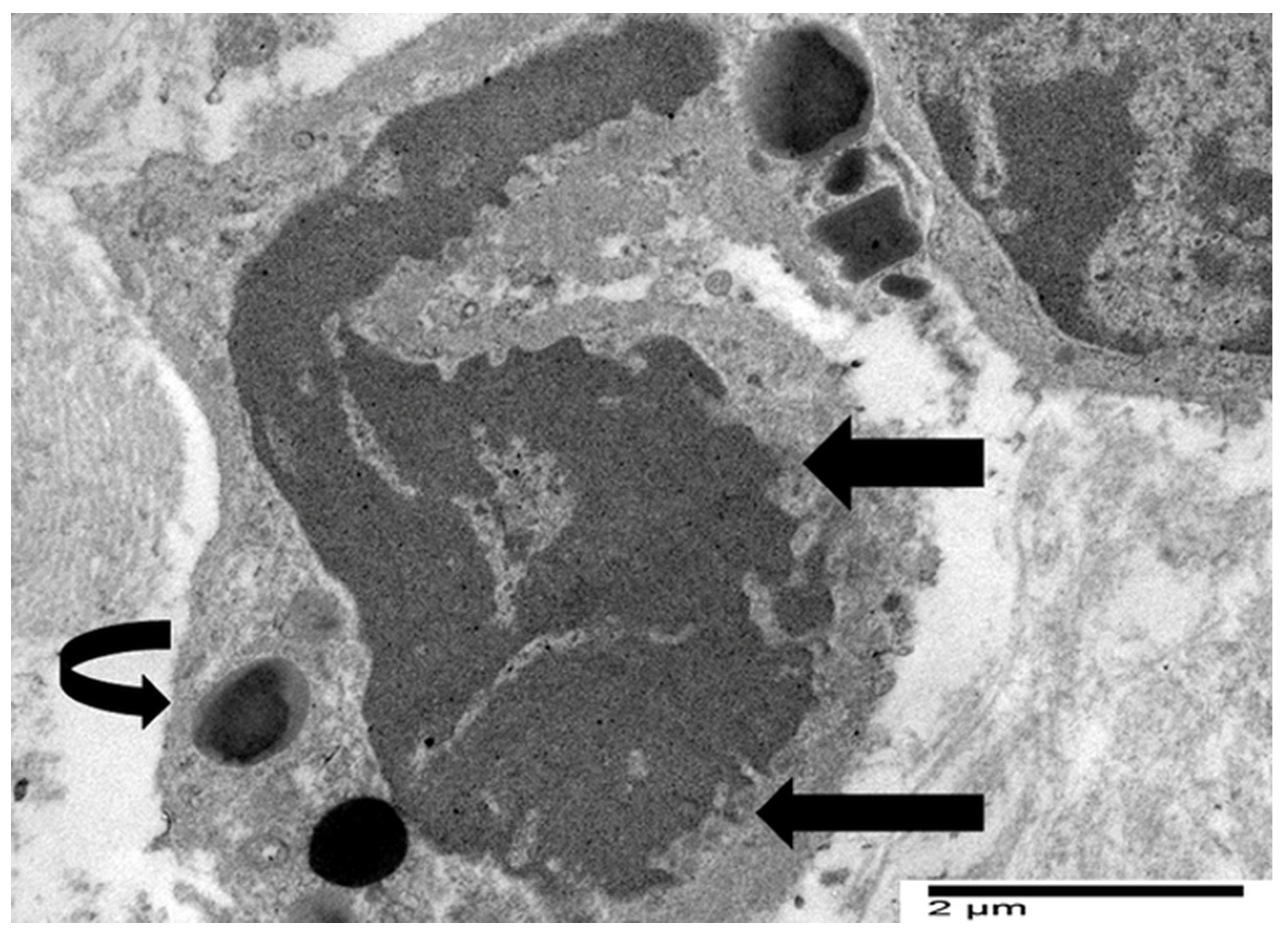 Cancers 17 03250 g005 Cancers 17 03250 g005