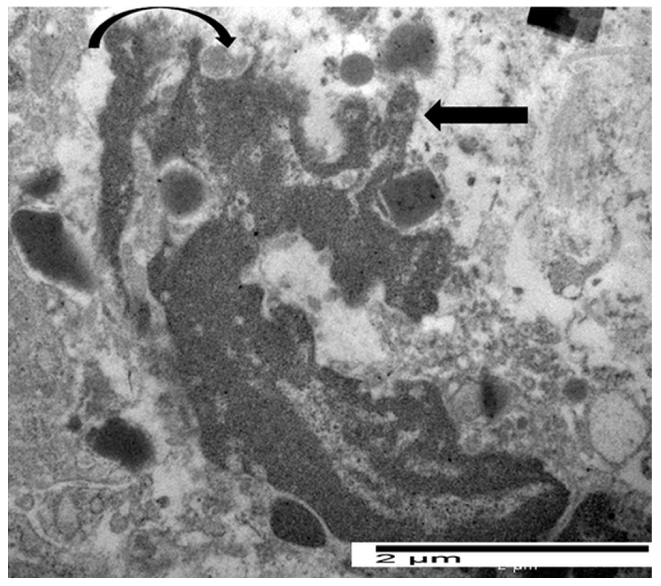 Cancers 17 03250 g006 Cancers 17 03250 g006