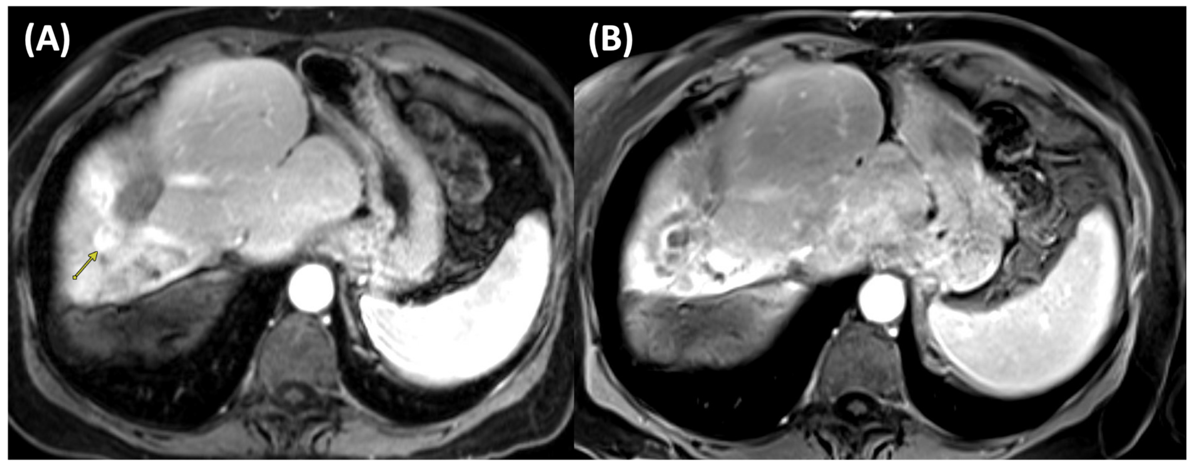 Cancers 17 03251 g002