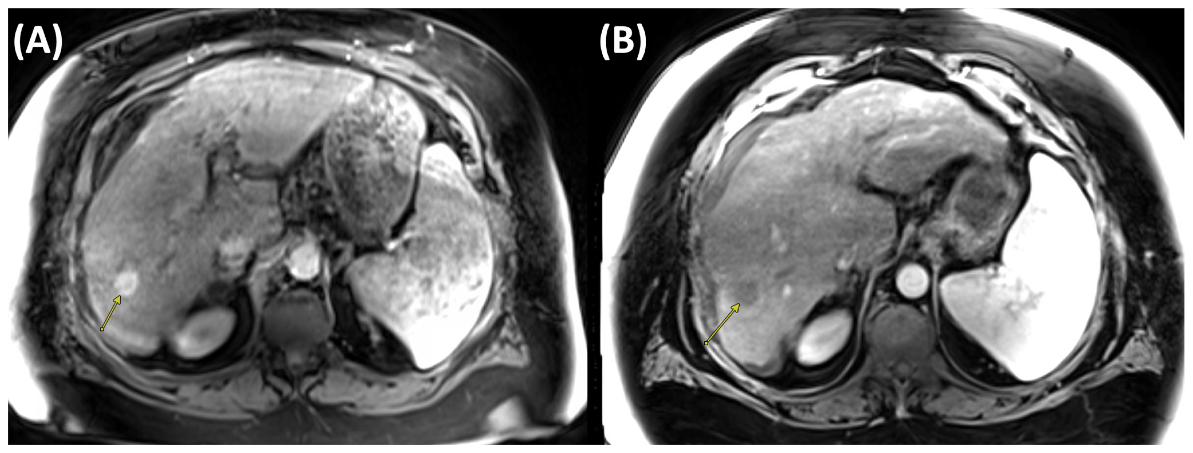 Cancers 17 03251 g003