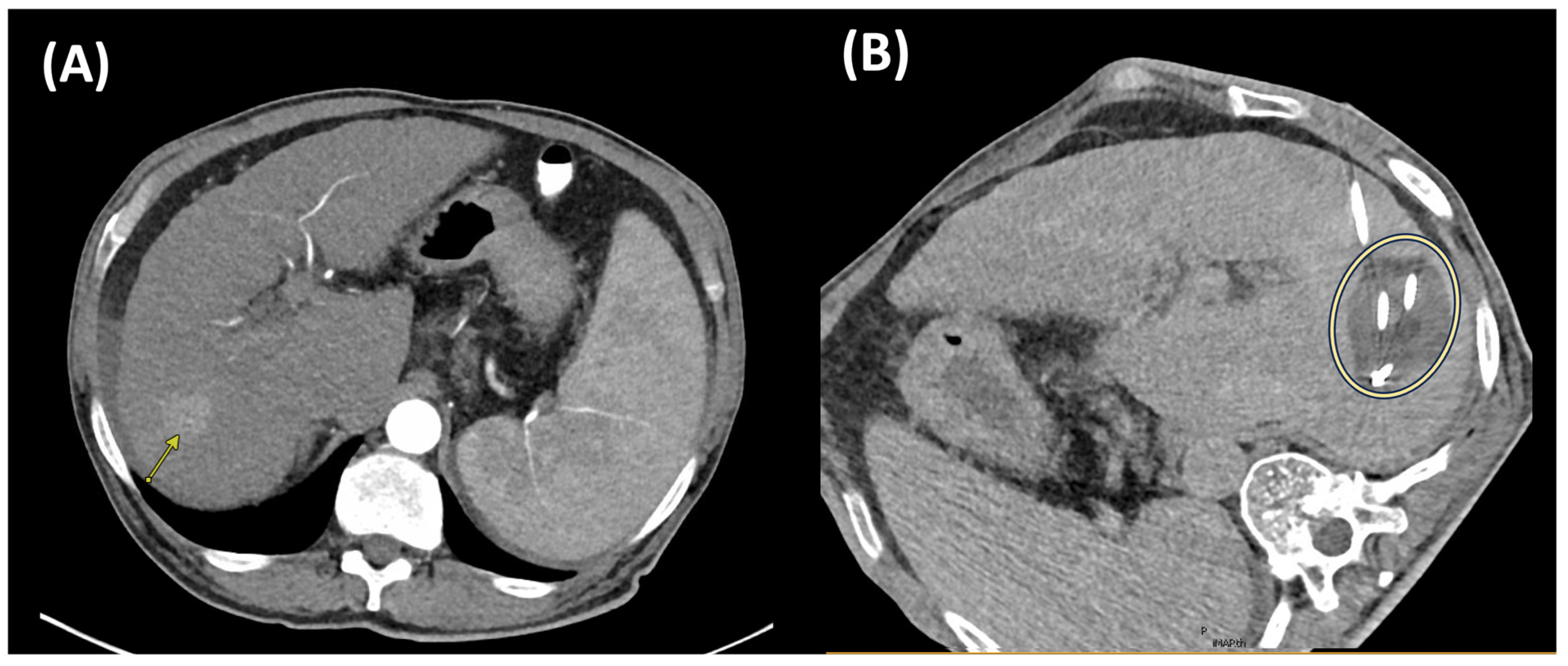 Cancers 17 03251 g004