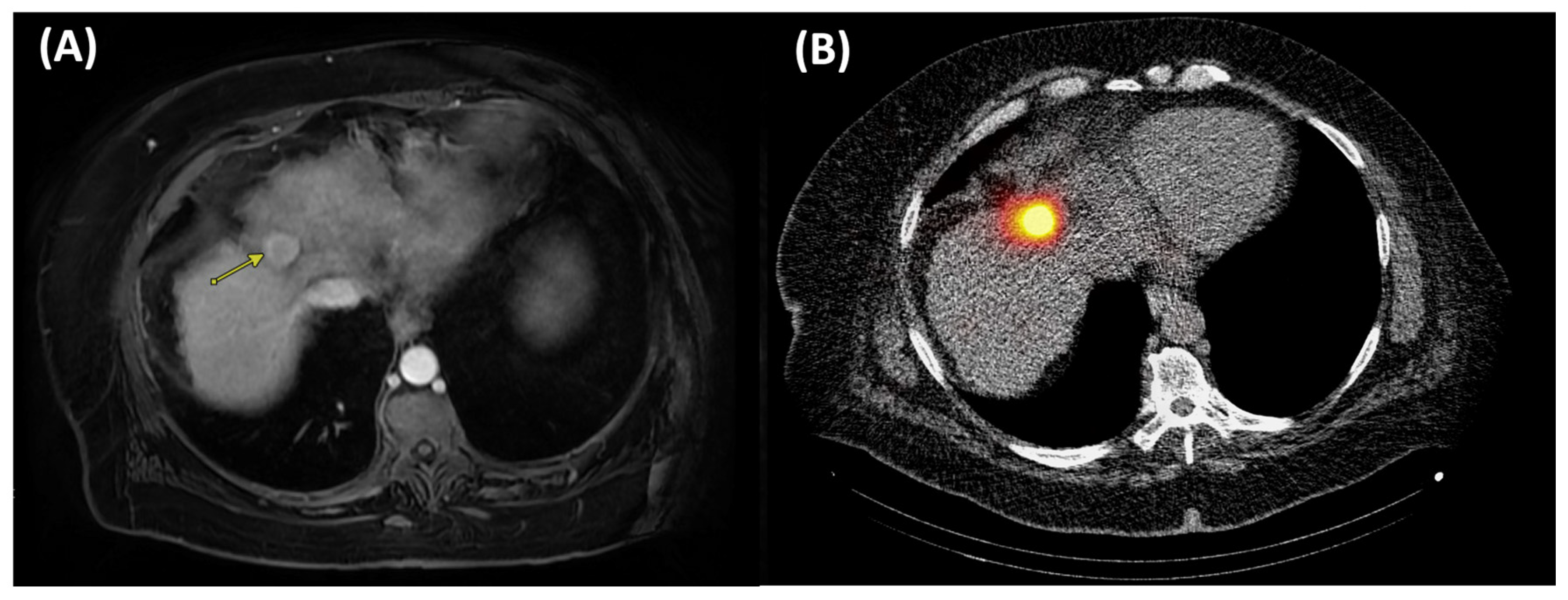 Cancers 17 03251 g006