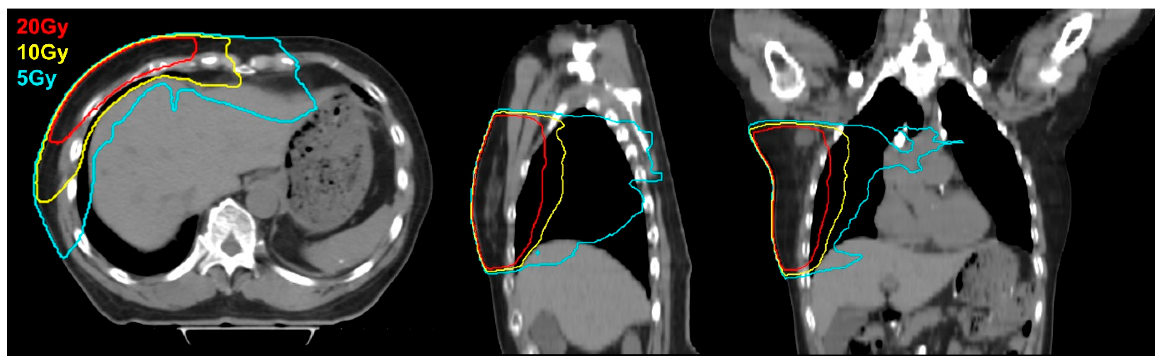 Comprehensive Evaluation of Hepatotoxicity Following
