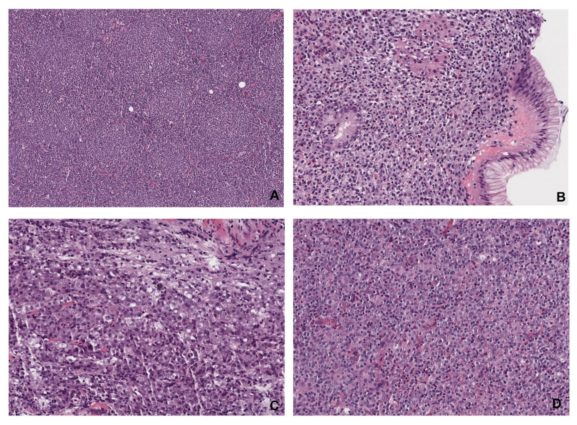 Cancers 17 03264 g003