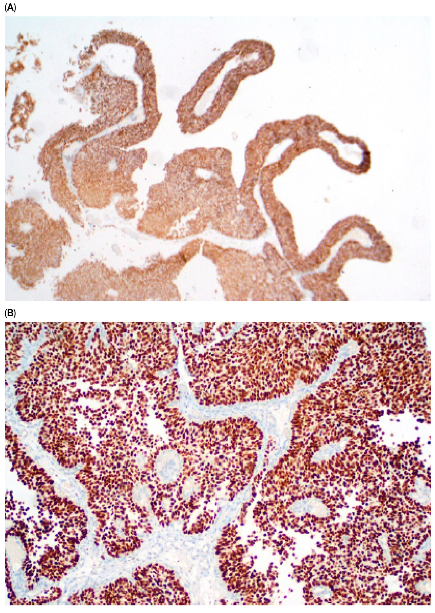 Cancers 17 03267 g001