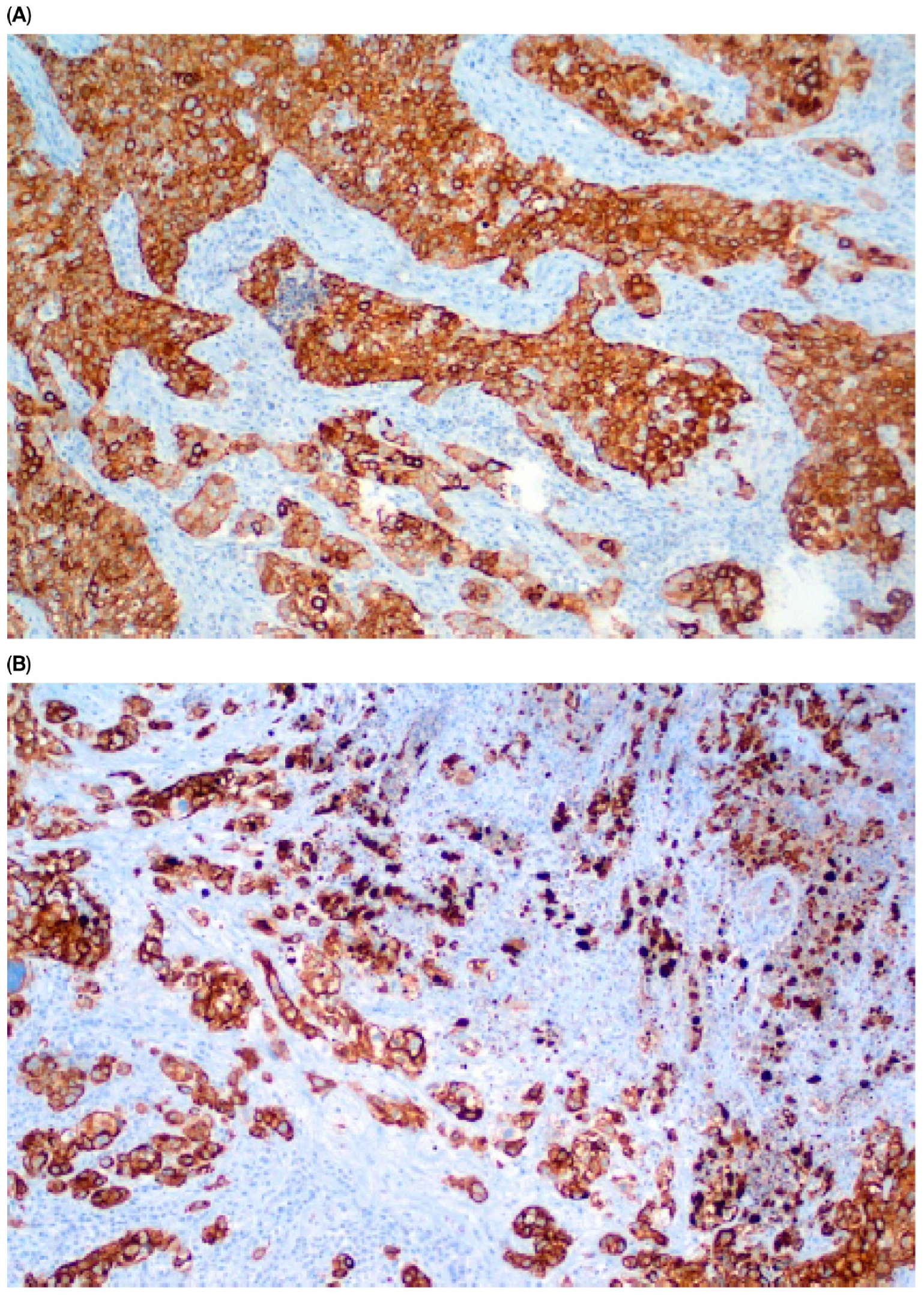 Cancers 17 03267 g002