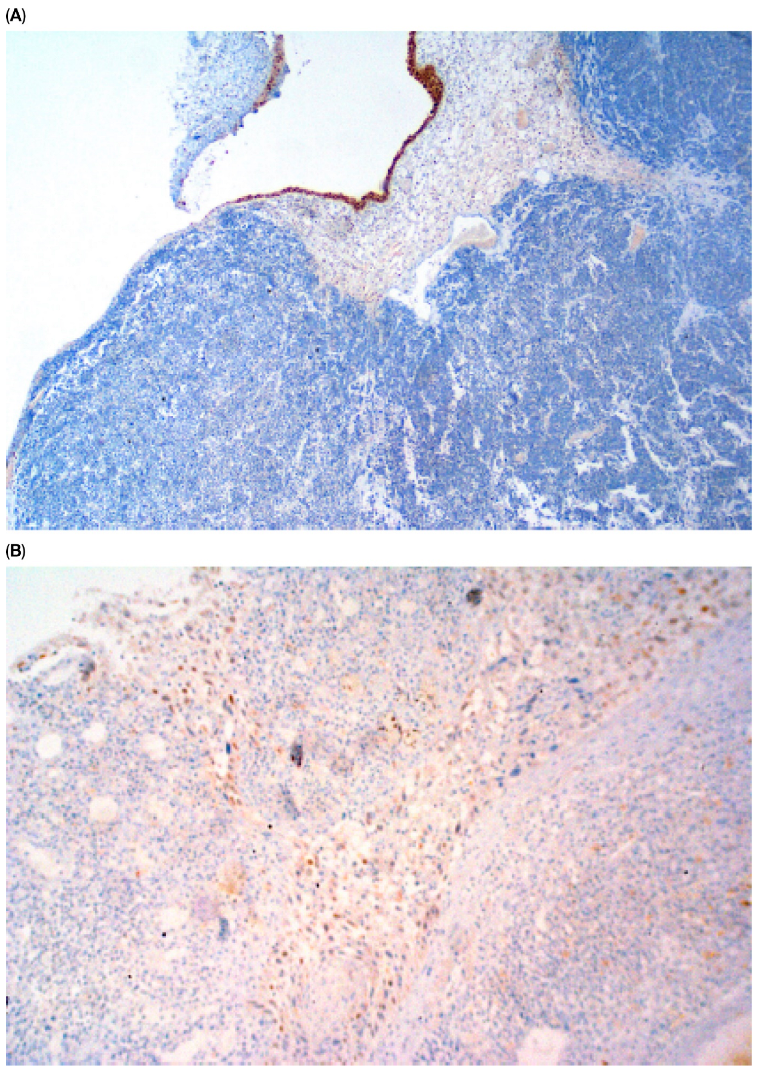 Cancers 17 03267 g003