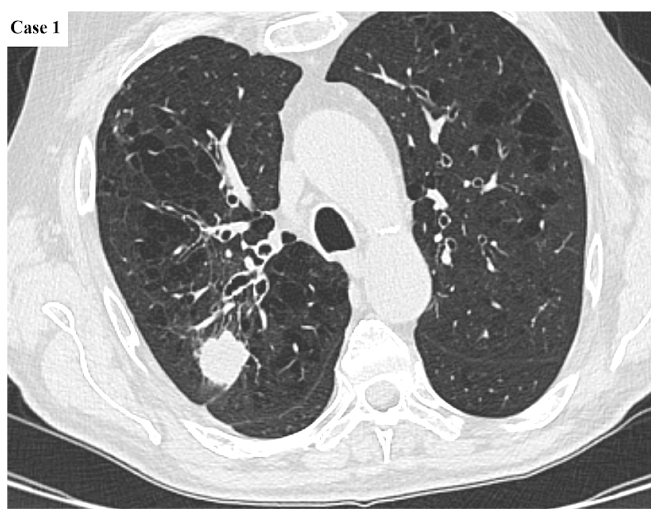 Cancers 17 03290 g001 Cancers 17 03290 g001