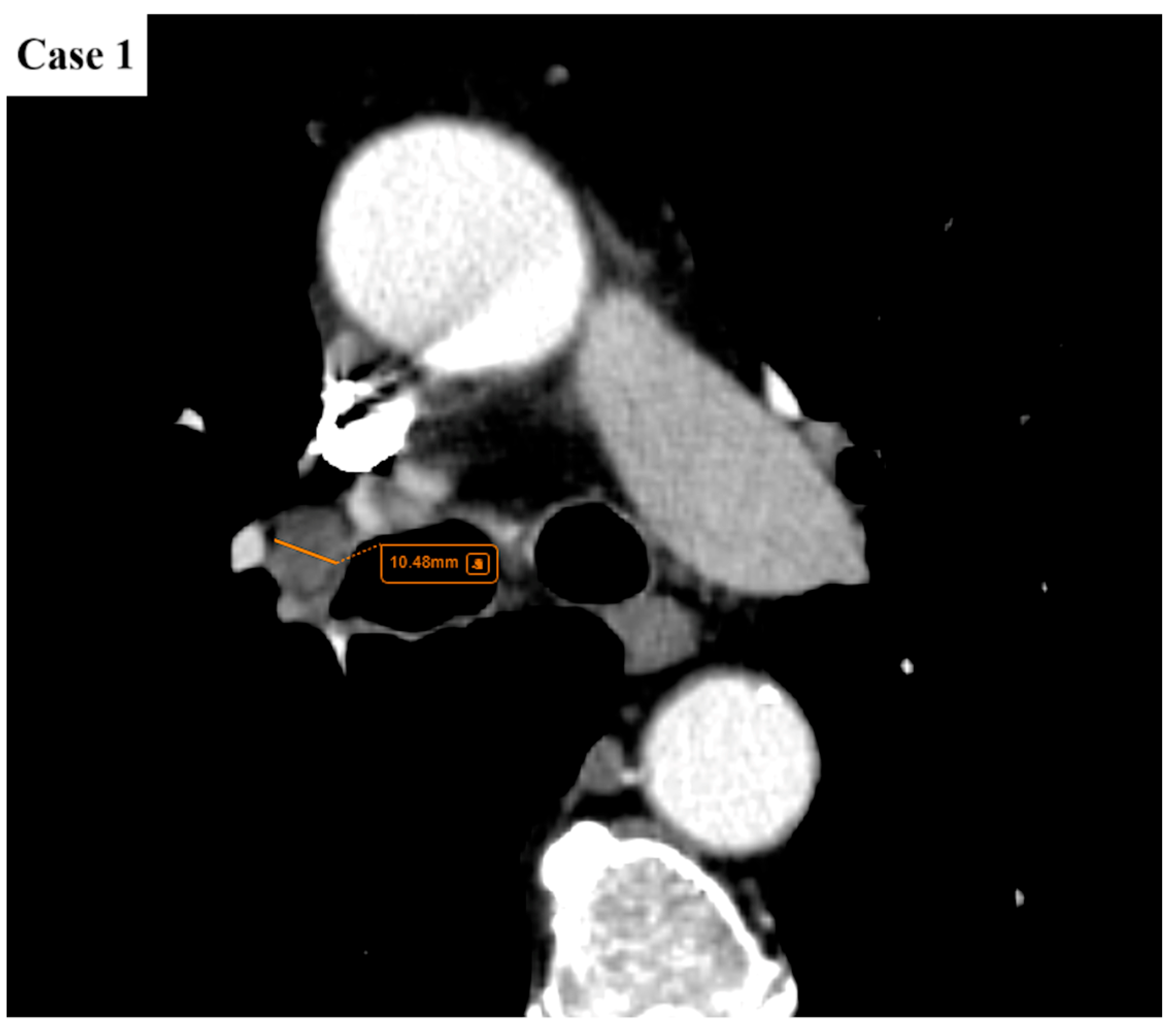 Cancers 17 03290 g002 Cancers 17 03290 g002