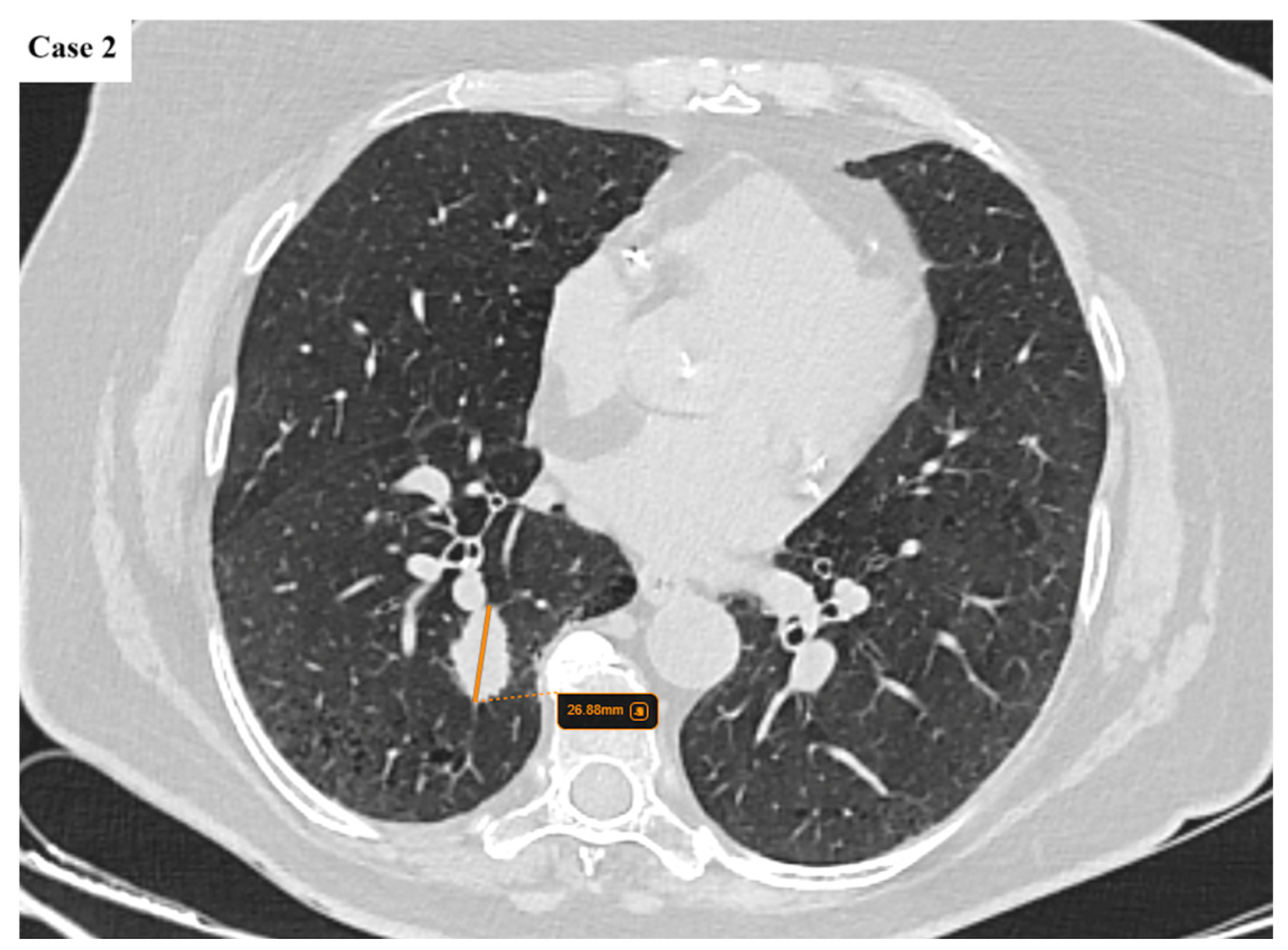 Cancers 17 03290 g003 Cancers 17 03290 g003