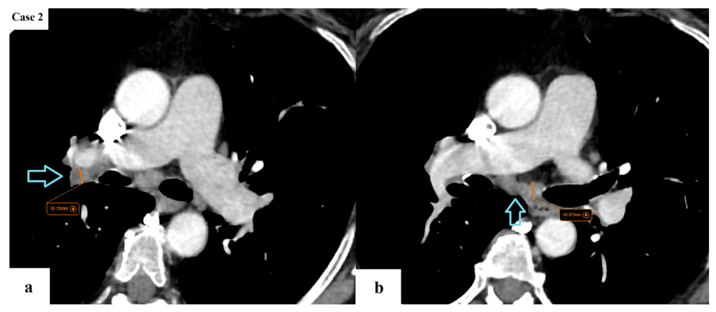 Cancers 17 03290 g004 Cancers 17 03290 g004