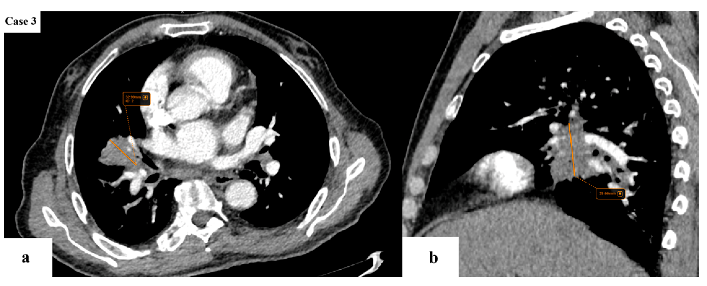 Cancers 17 03290 g005 Cancers 17 03290 g005