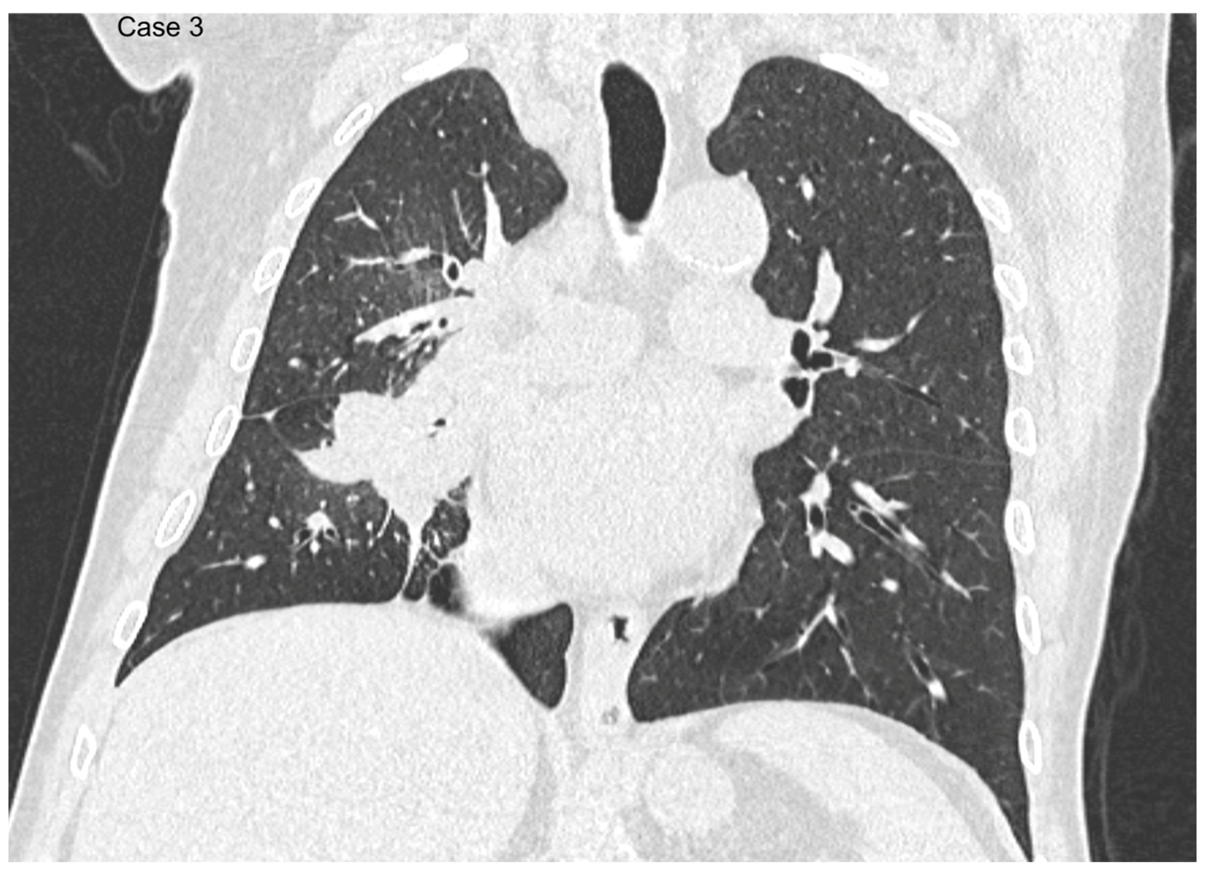 Cancers 17 03290 g006 Cancers 17 03290 g006