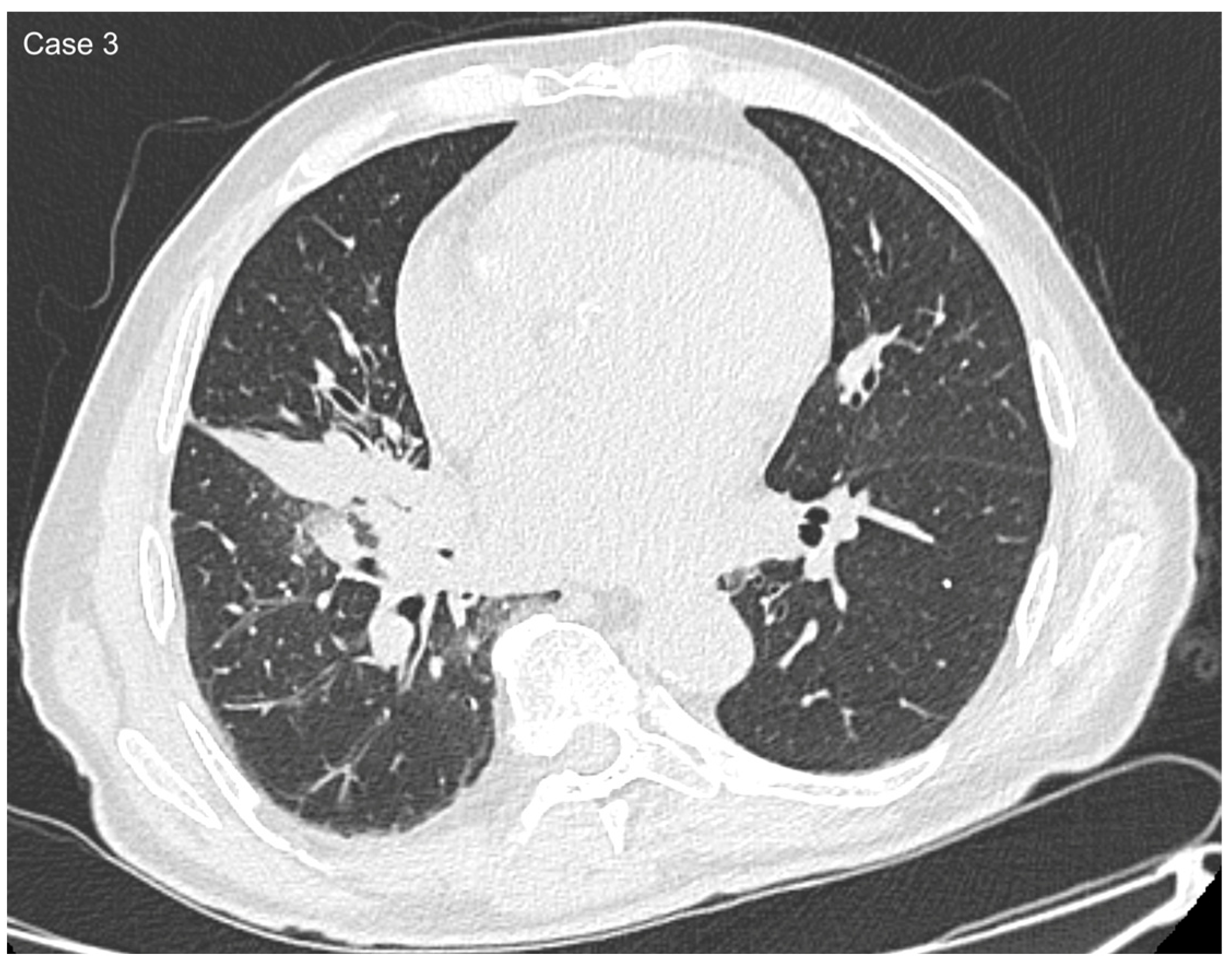 Cancers 17 03290 g007 Cancers 17 03290 g007