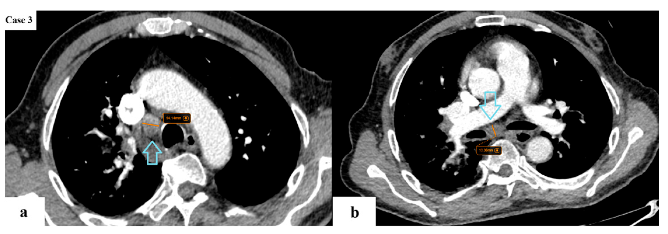 Cancers 17 03290 g008 Cancers 17 03290 g008