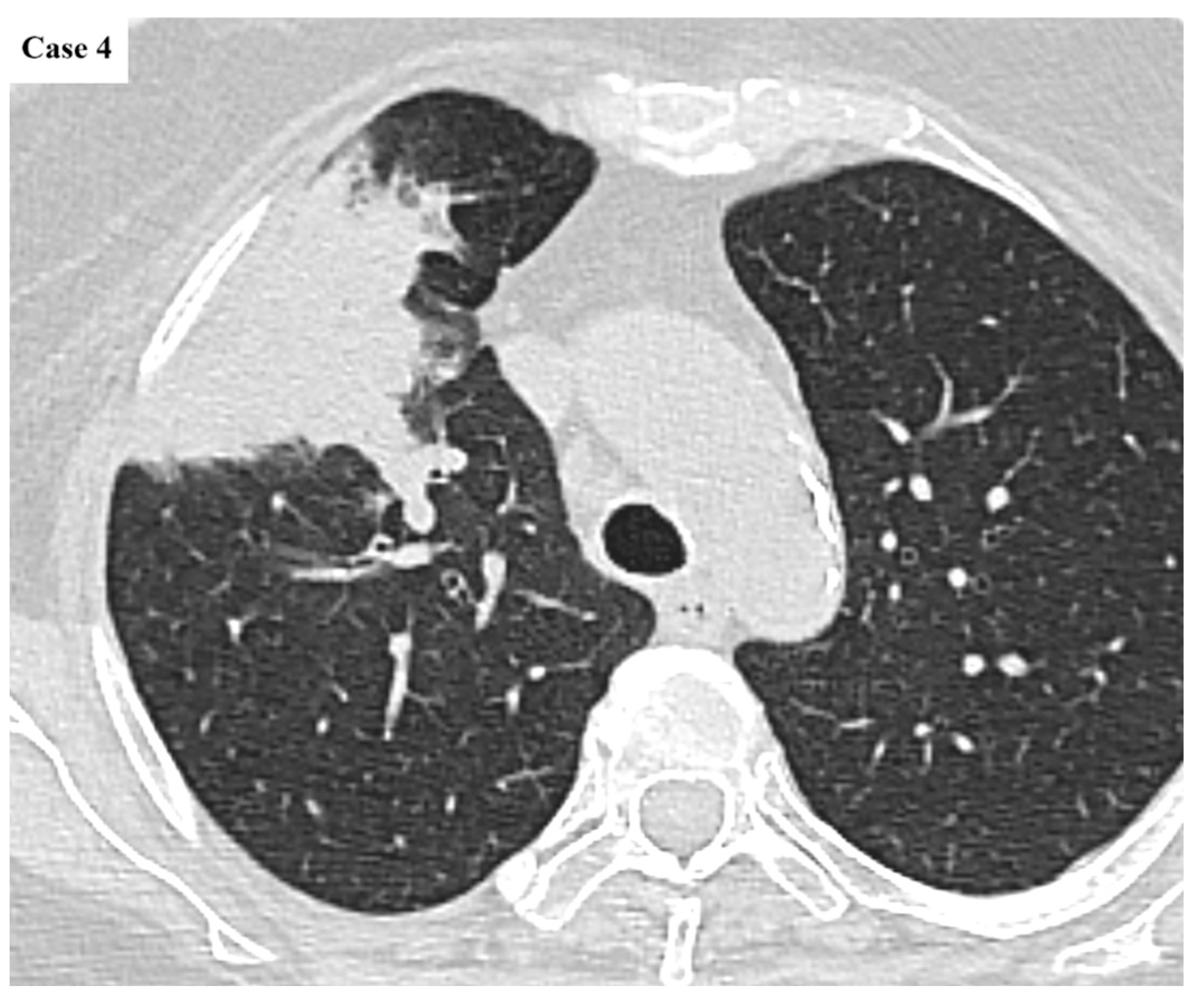 Cancers 17 03290 g009 Cancers 17 03290 g009