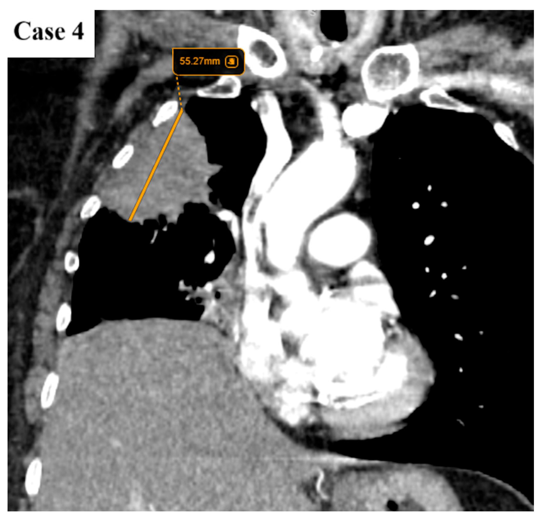 Cancers 17 03290 g010 Cancers 17 03290 g010
