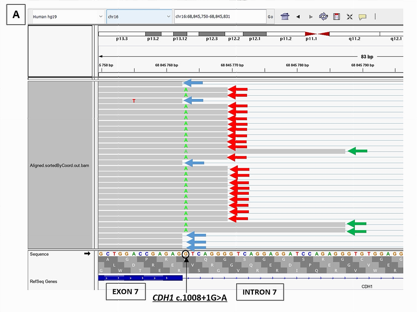 Cancers 17 03320 g004a Cancers 17 03320 g004a