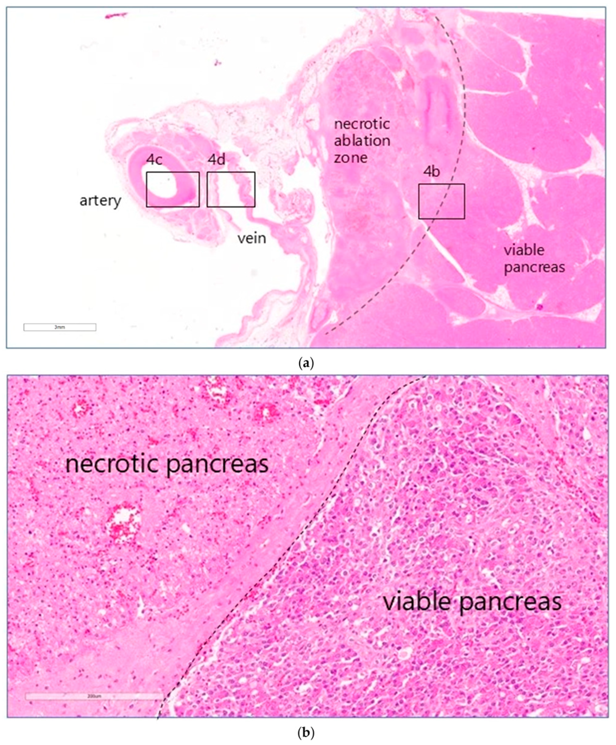 Cancers 17 03340 g004a