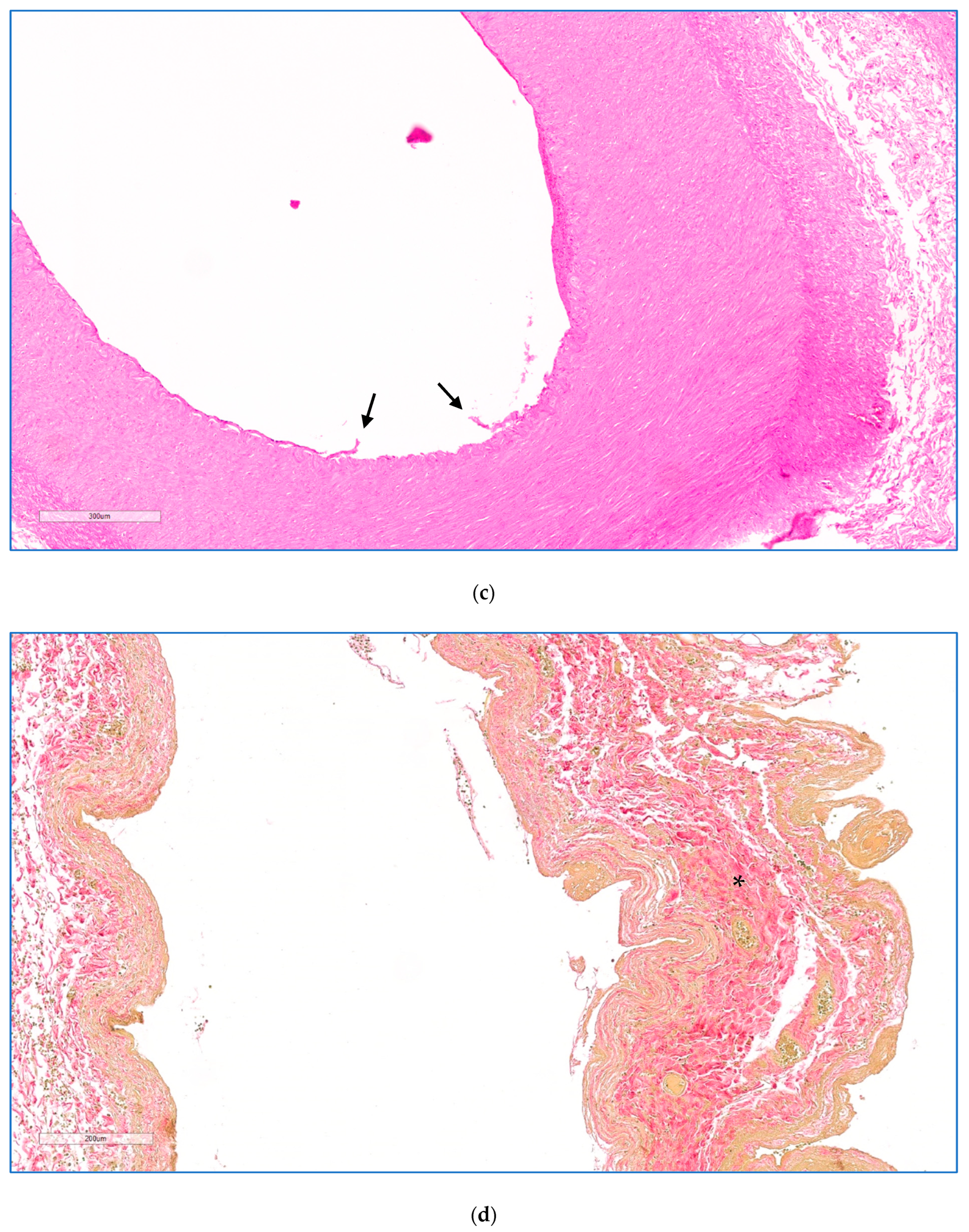 Cancers 17 03340 g004b