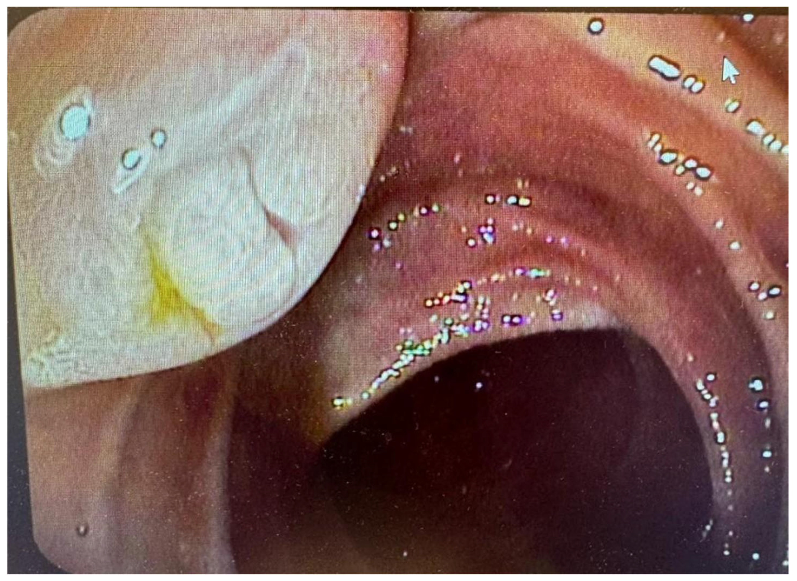 Cancers 17 03341 g002