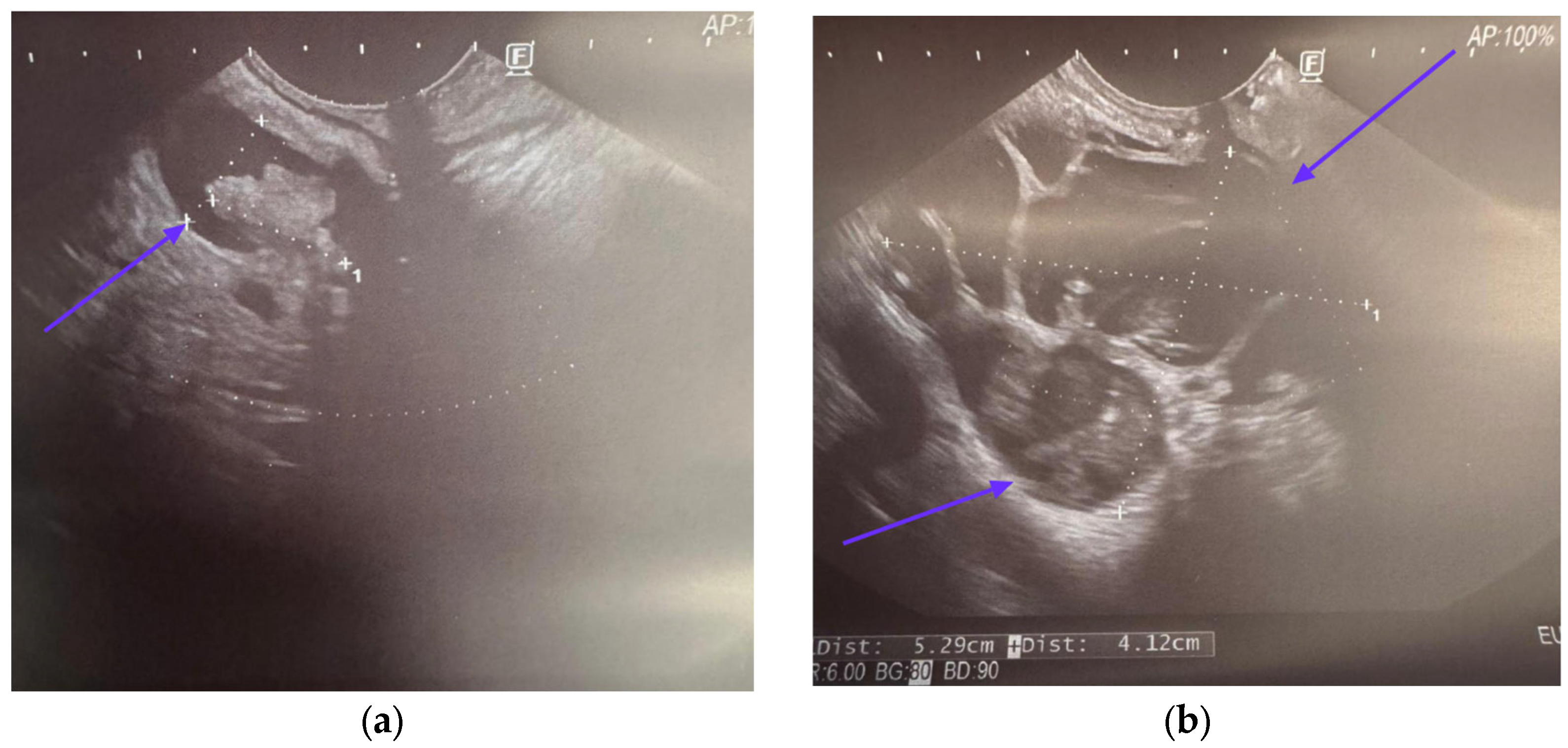 Cancers 17 03341 g003