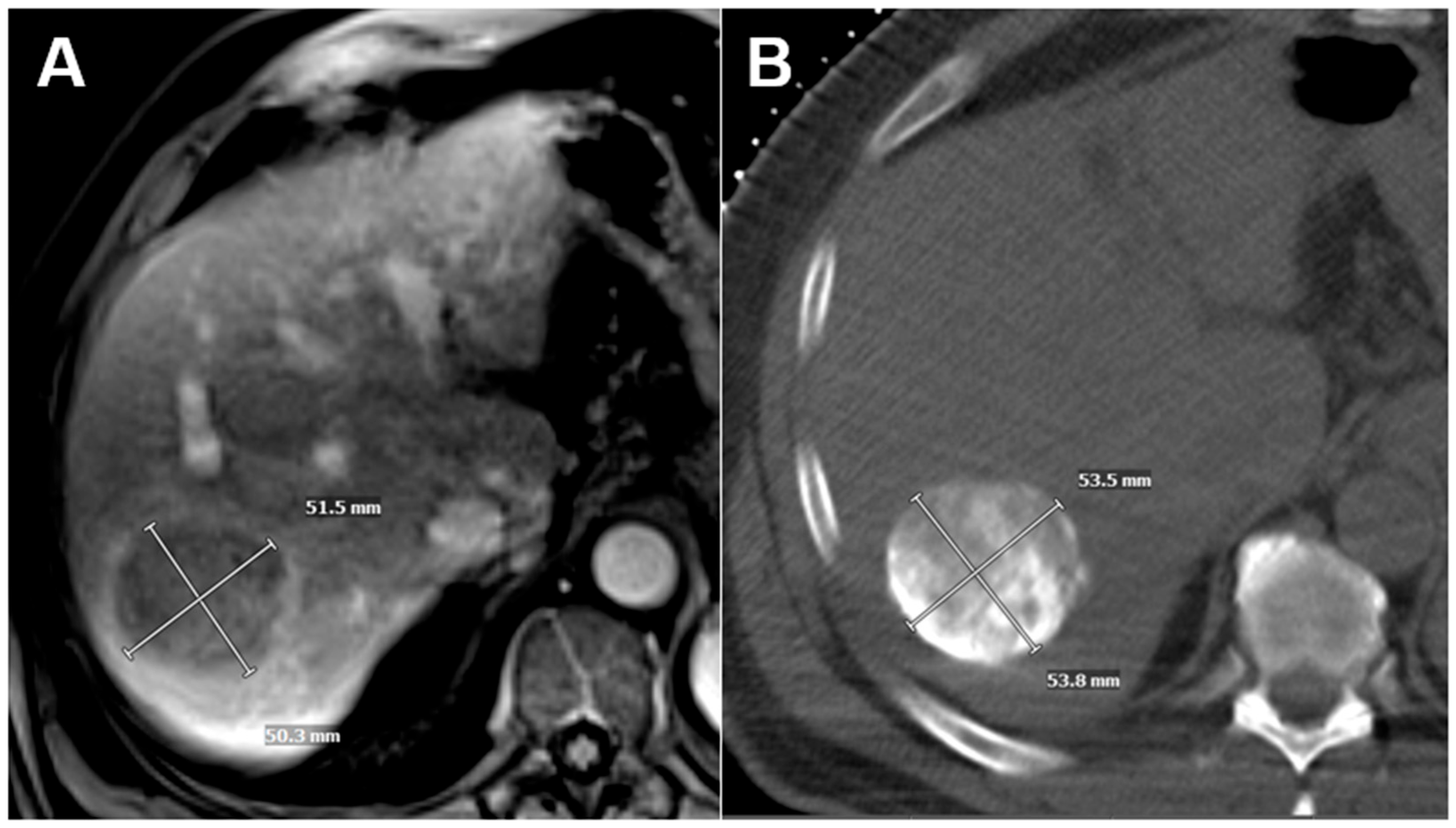 Cancers 17 03346 g001