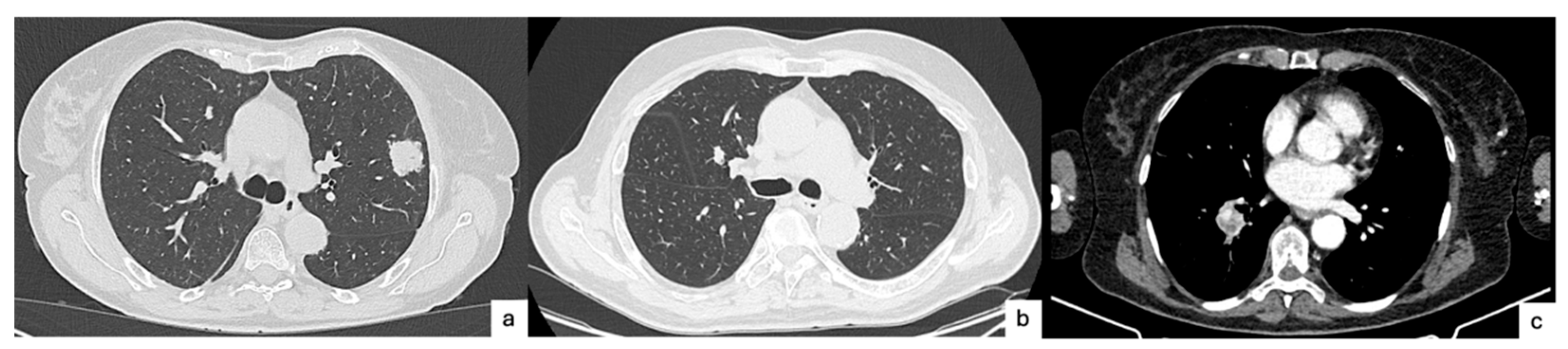 Cancers 17 03374 g001 Cancers 17 03374 g001