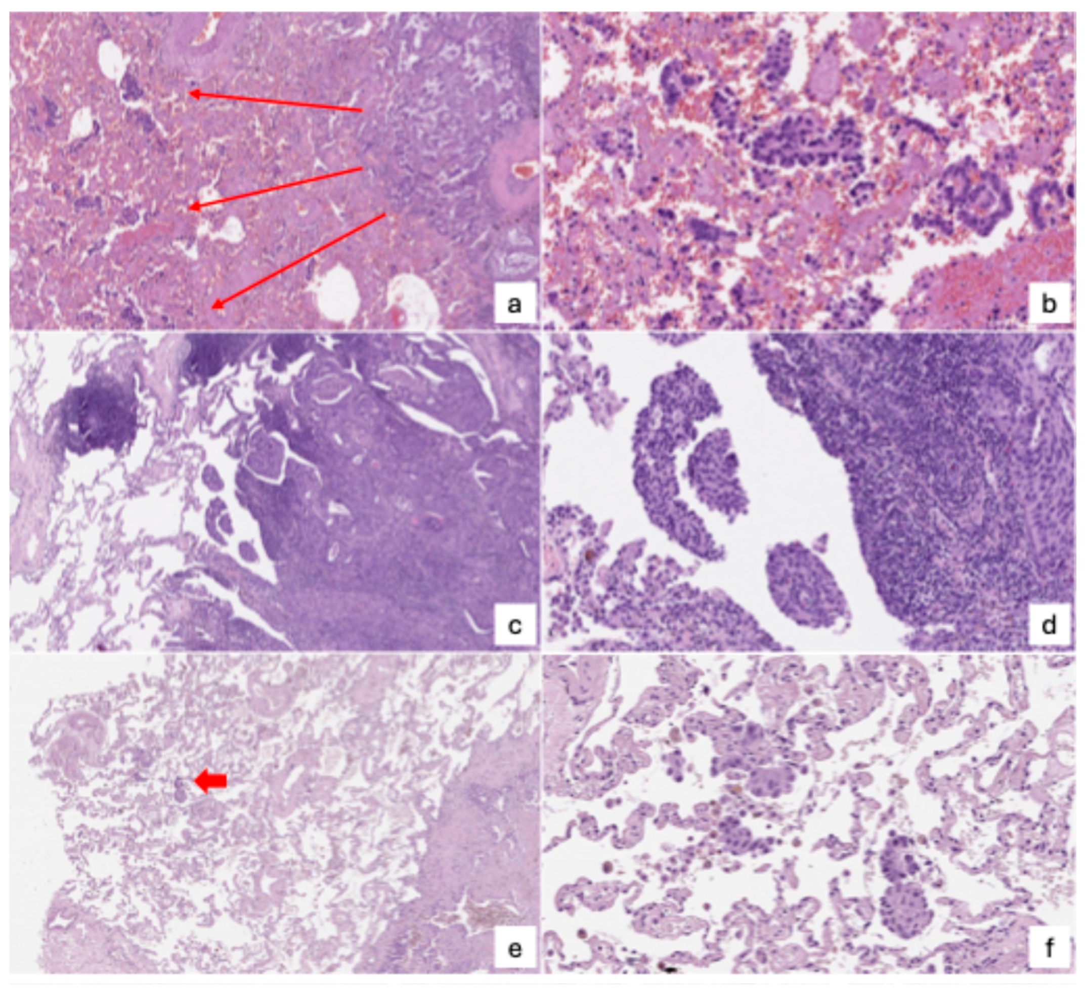 Cancers 17 03374 g003 Cancers 17 03374 g003