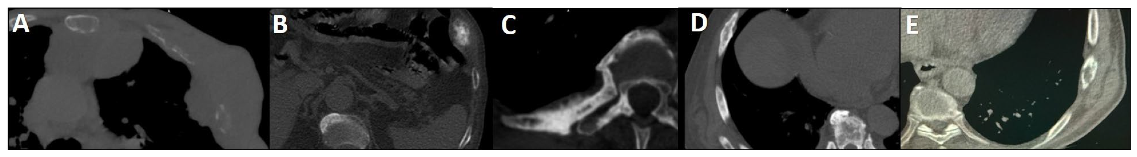 Cancers 17 03404 g001 Cancers 17 03404 g001