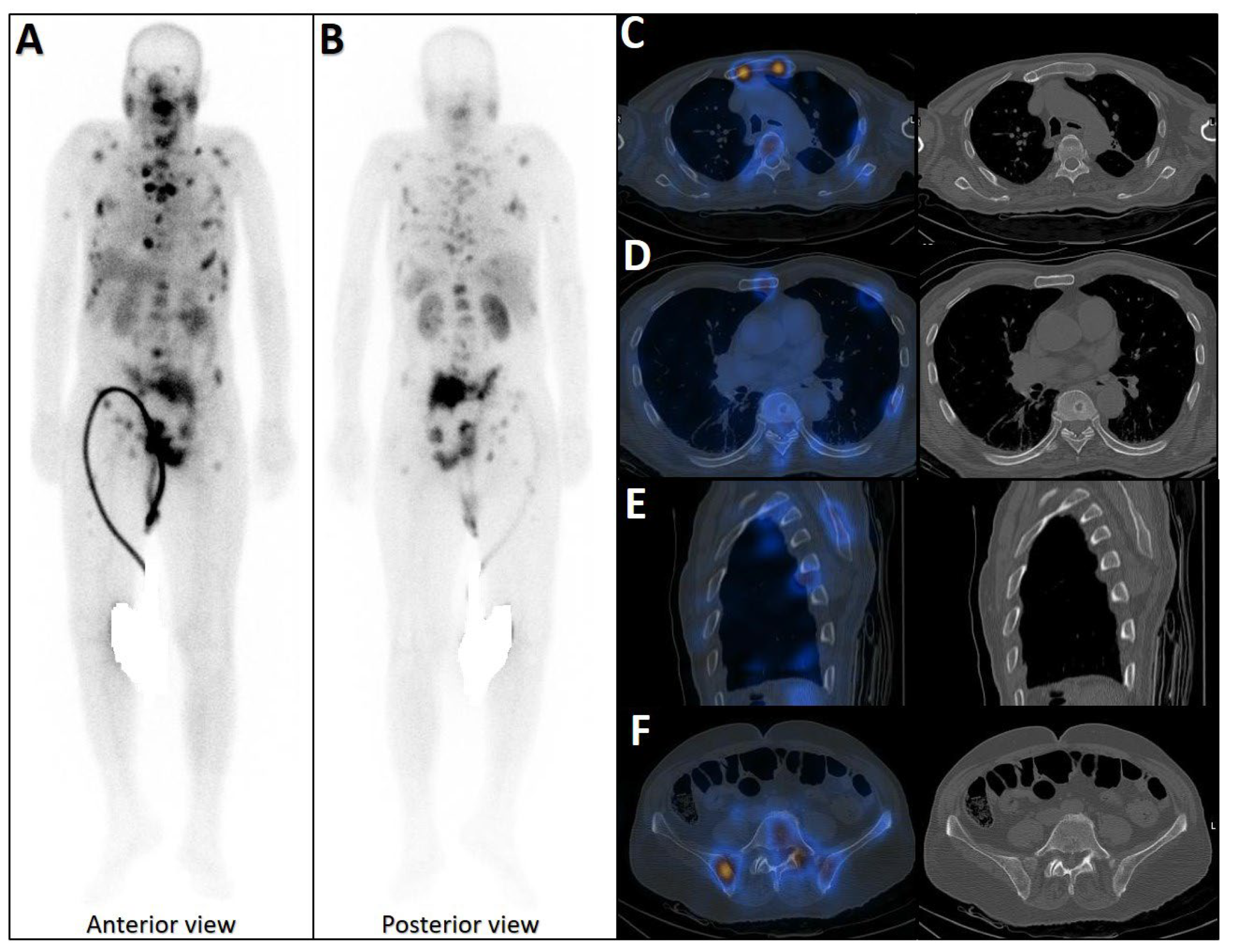 Cancers 17 03404 g002 Cancers 17 03404 g002