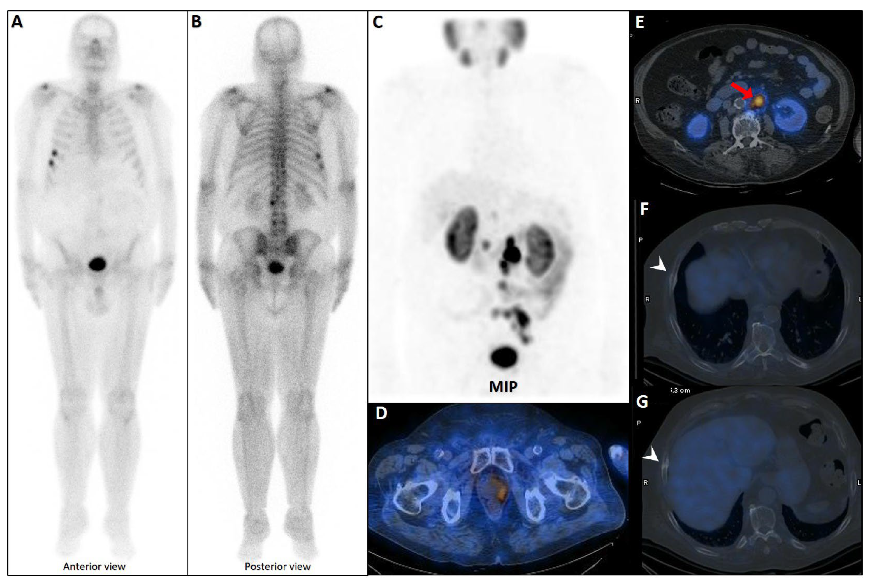 Cancers 17 03404 g003 Cancers 17 03404 g003