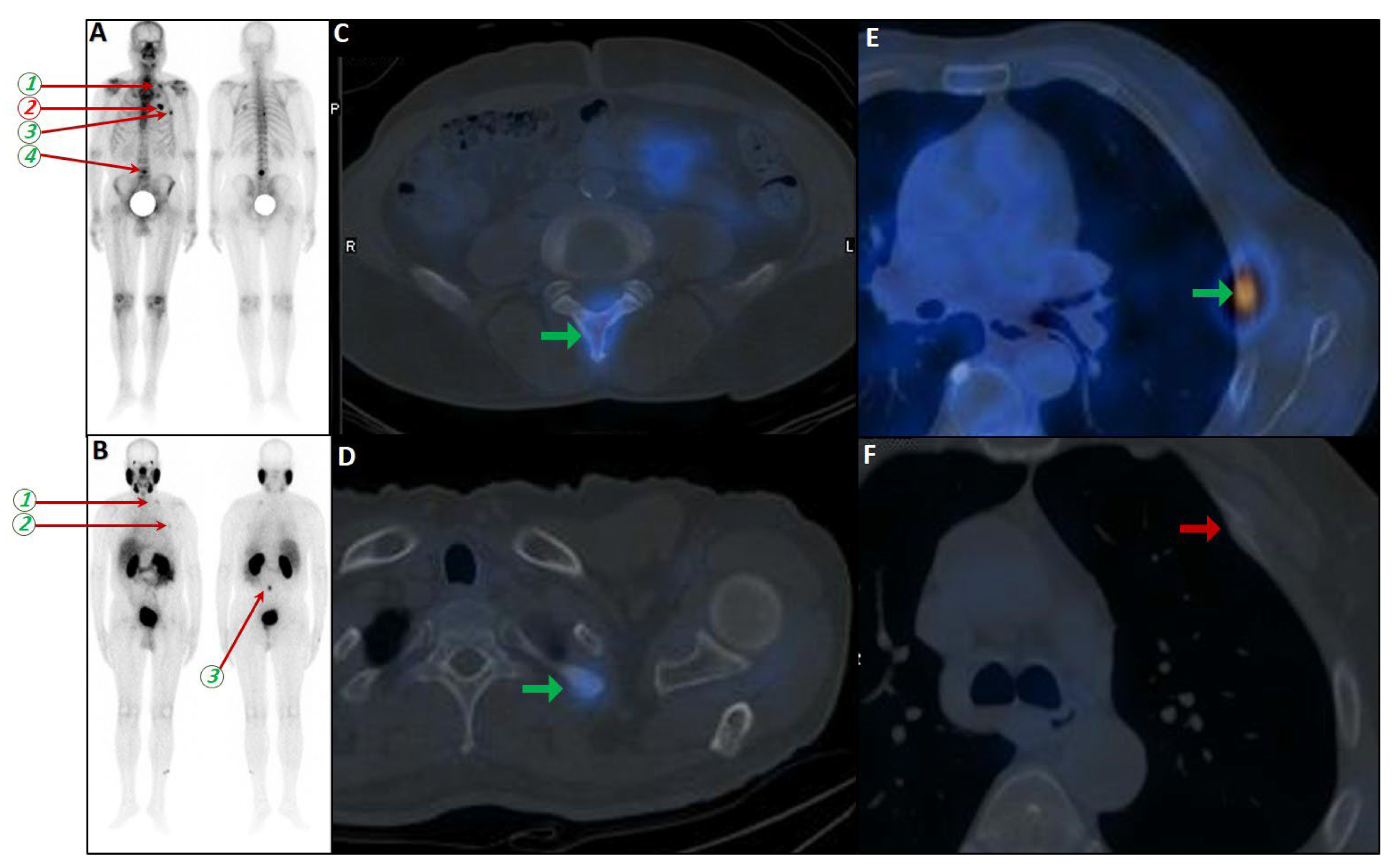 Cancers 17 03404 g004 Cancers 17 03404 g004