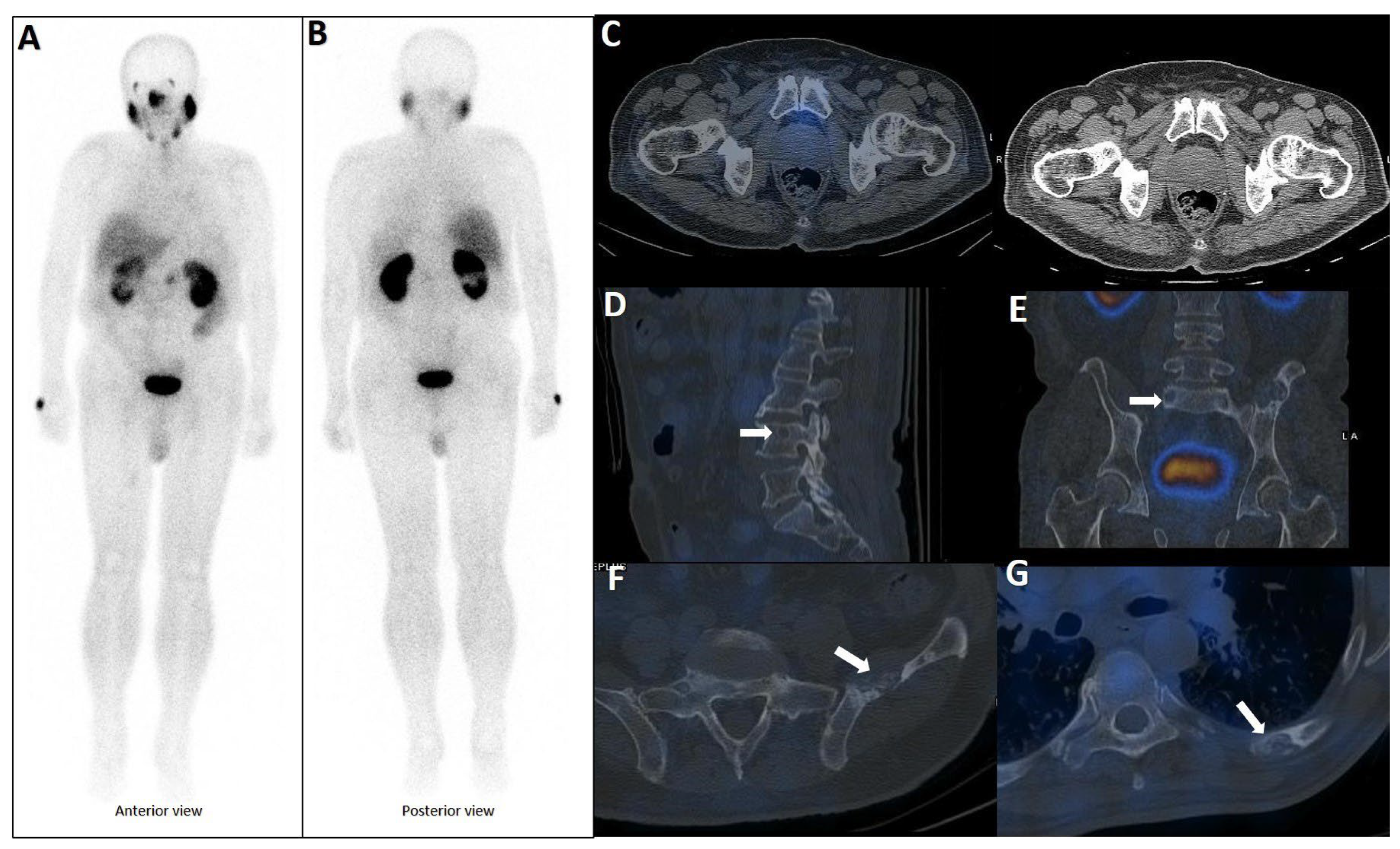 Cancers 17 03404 g005 Cancers 17 03404 g005