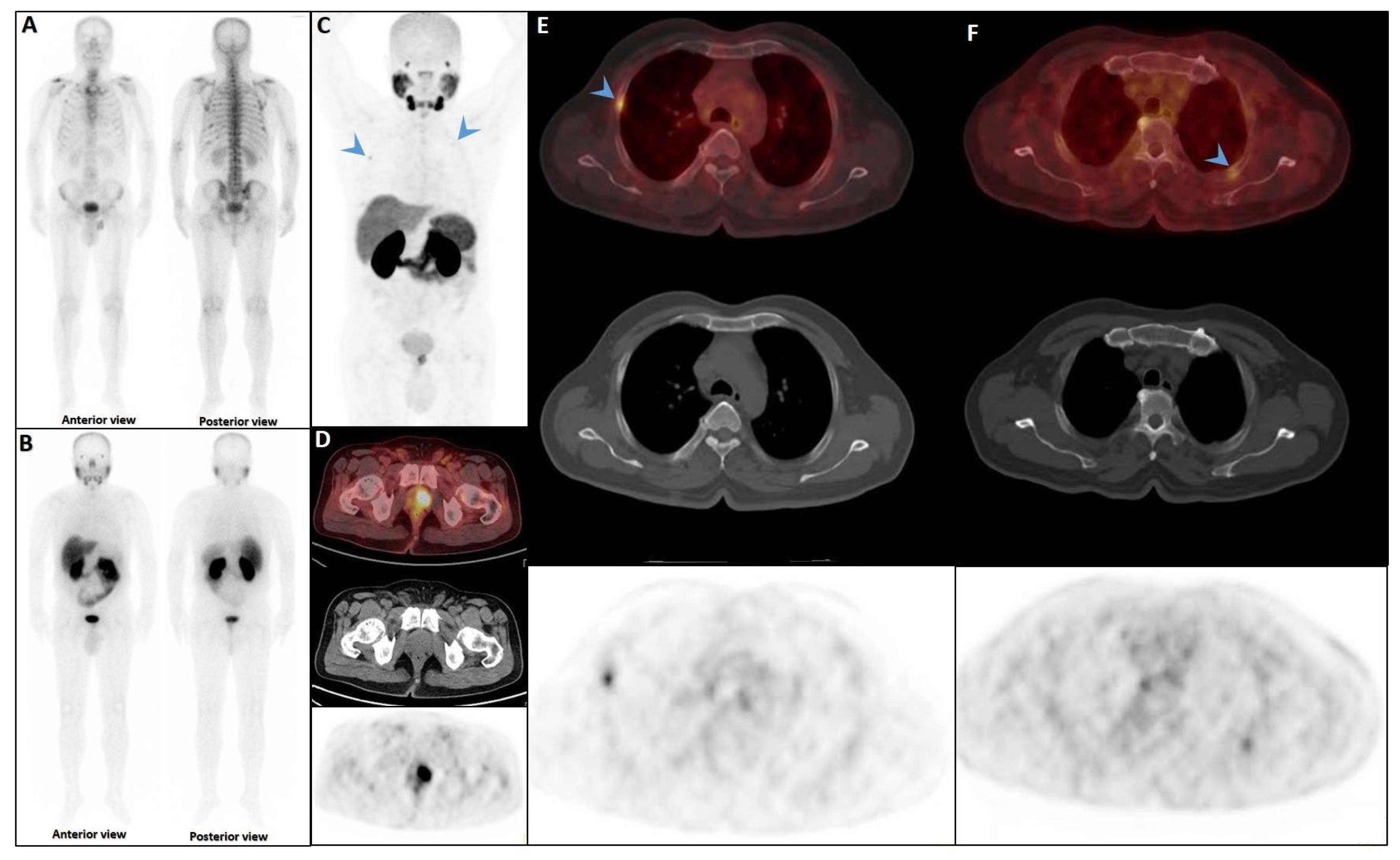 Cancers 17 03404 g006 Cancers 17 03404 g006