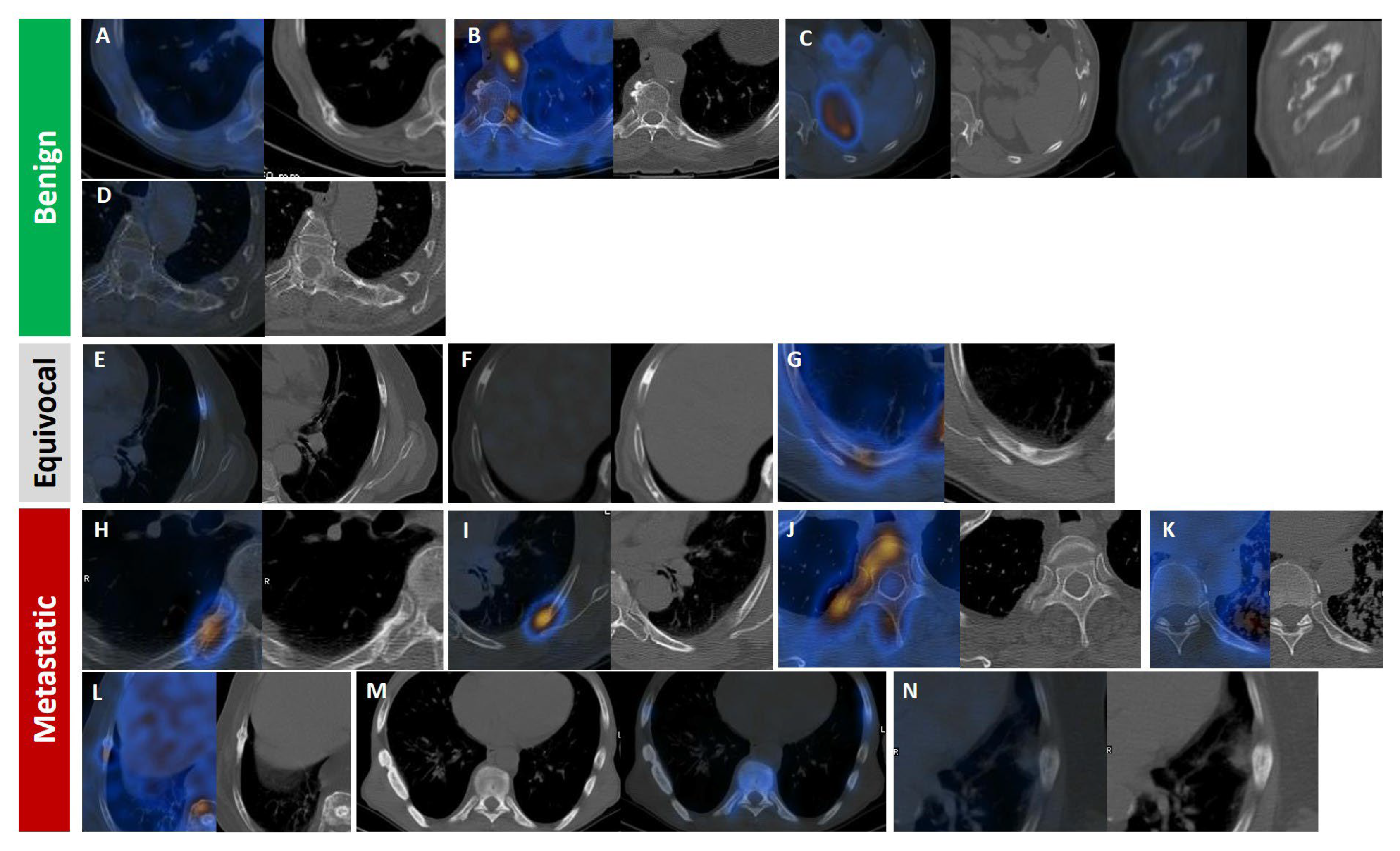 Cancers 17 03404 g007 Cancers 17 03404 g007